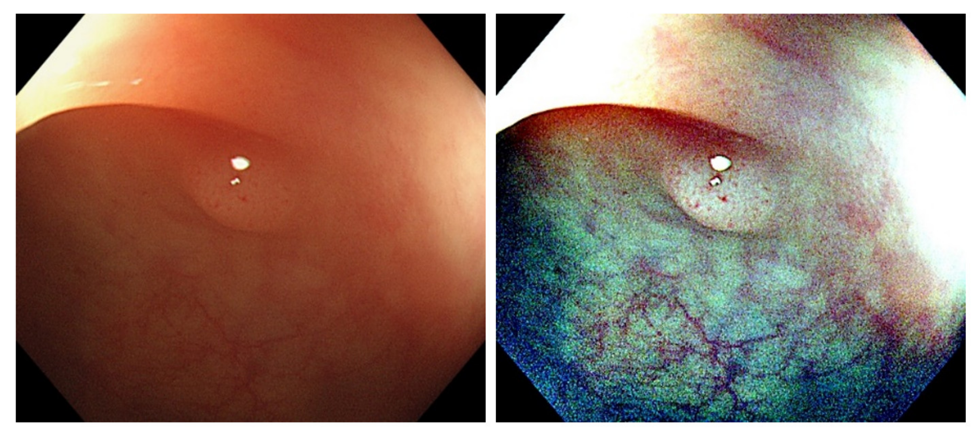 Diagnostics 12 00968 g006