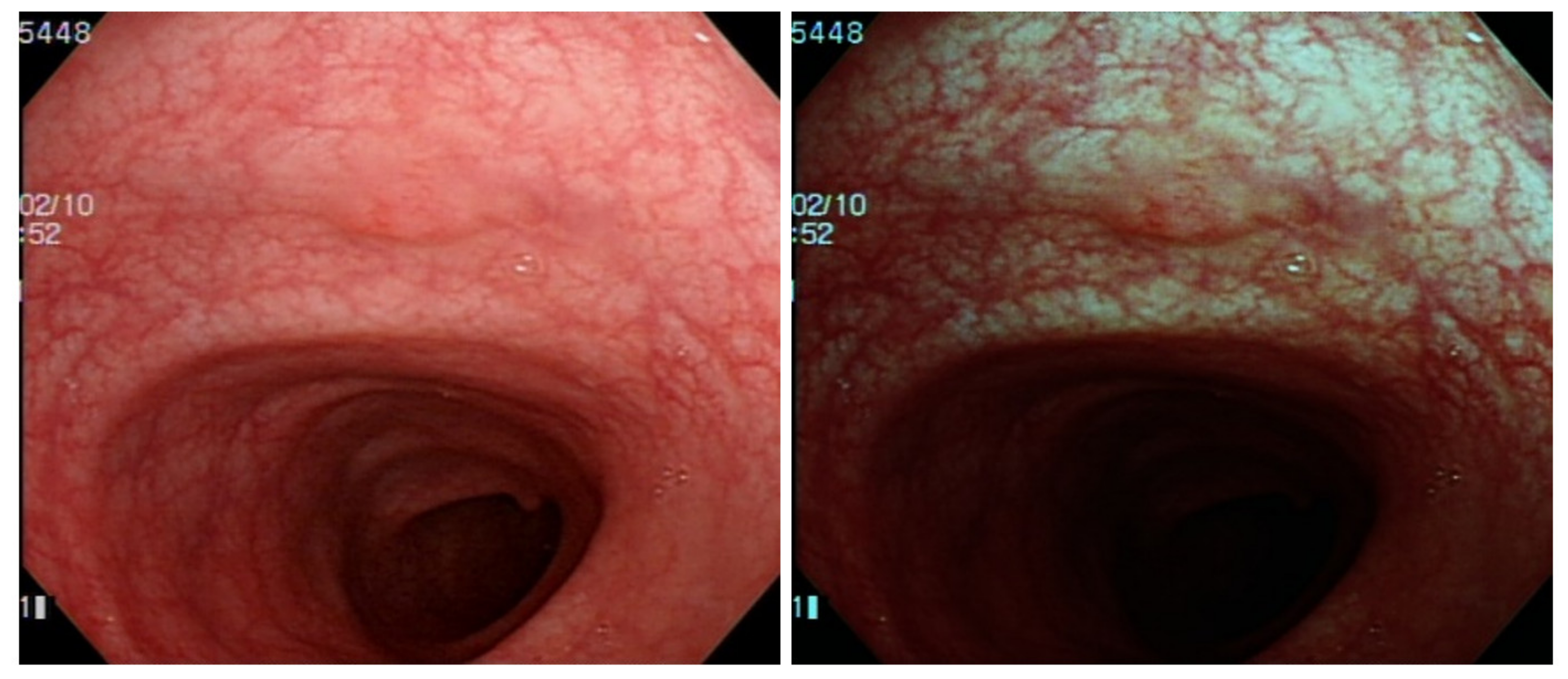 Diagnostics 12 00968 g009
