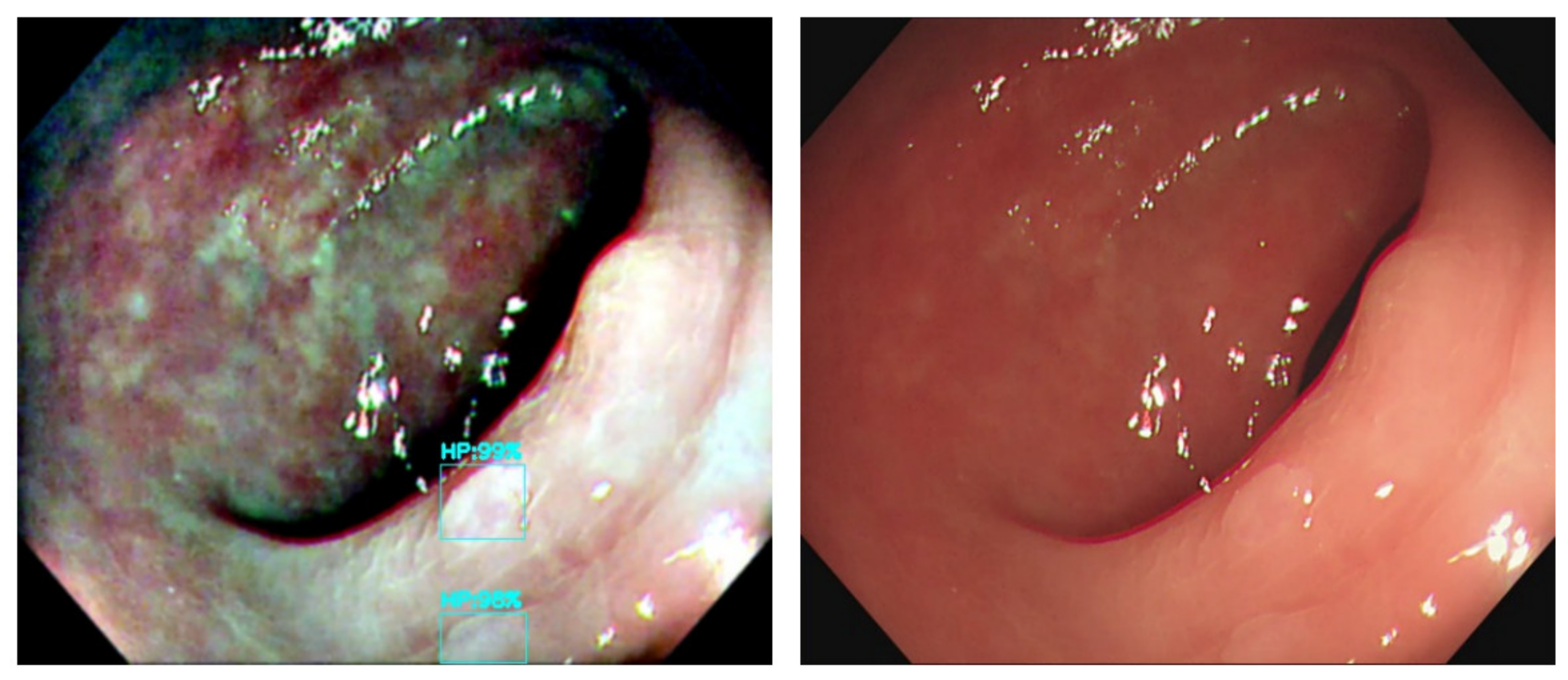 Diagnostics 12 00968 g012