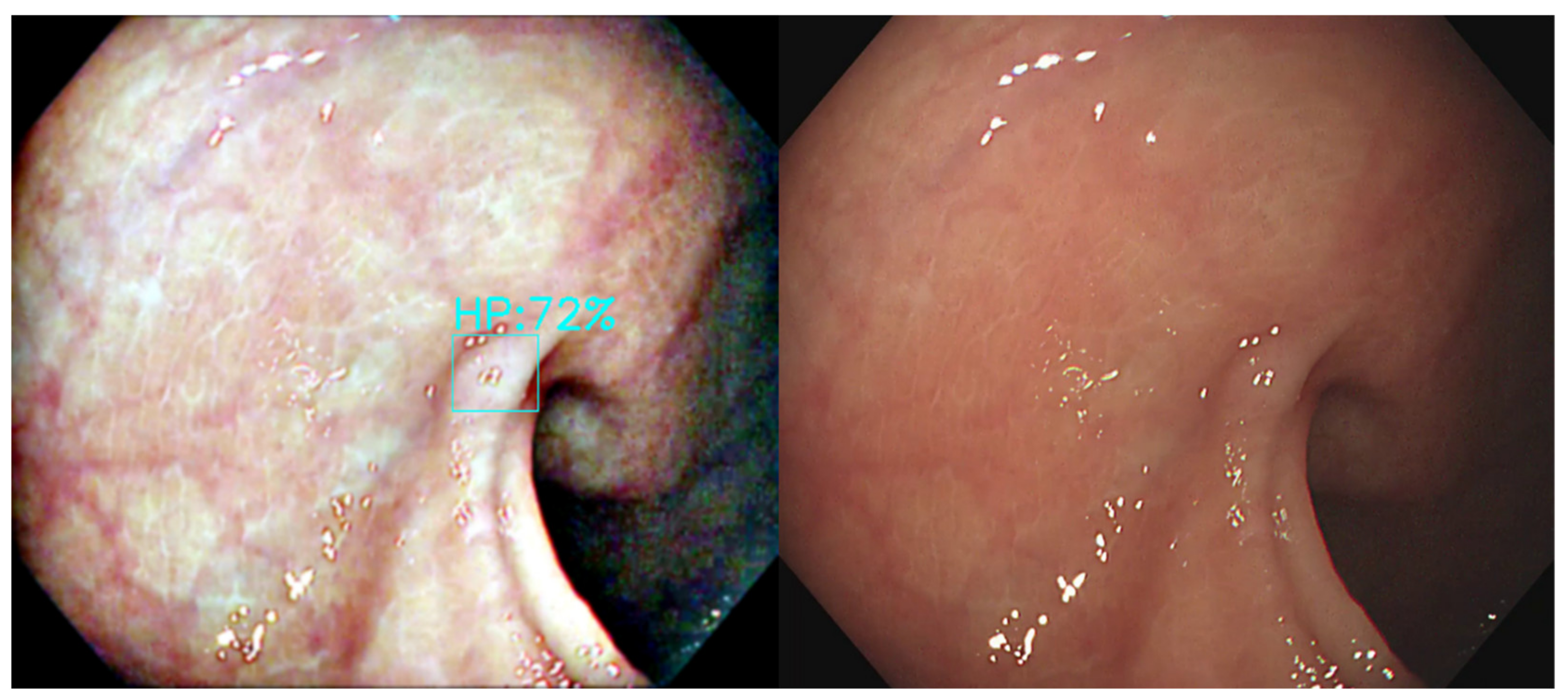 Diagnostics 12 00968 g014