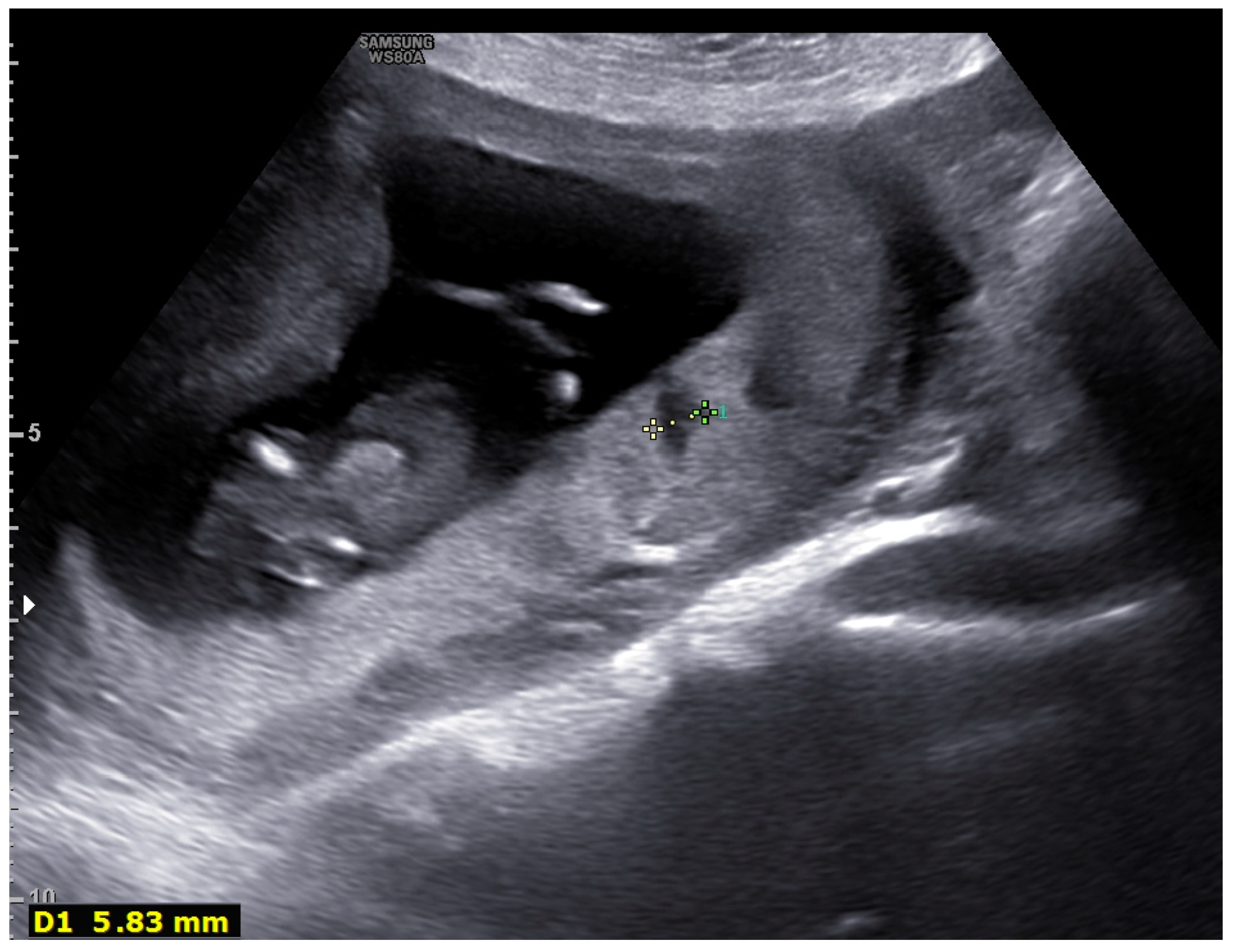 Diagnostics 12 00974 g002