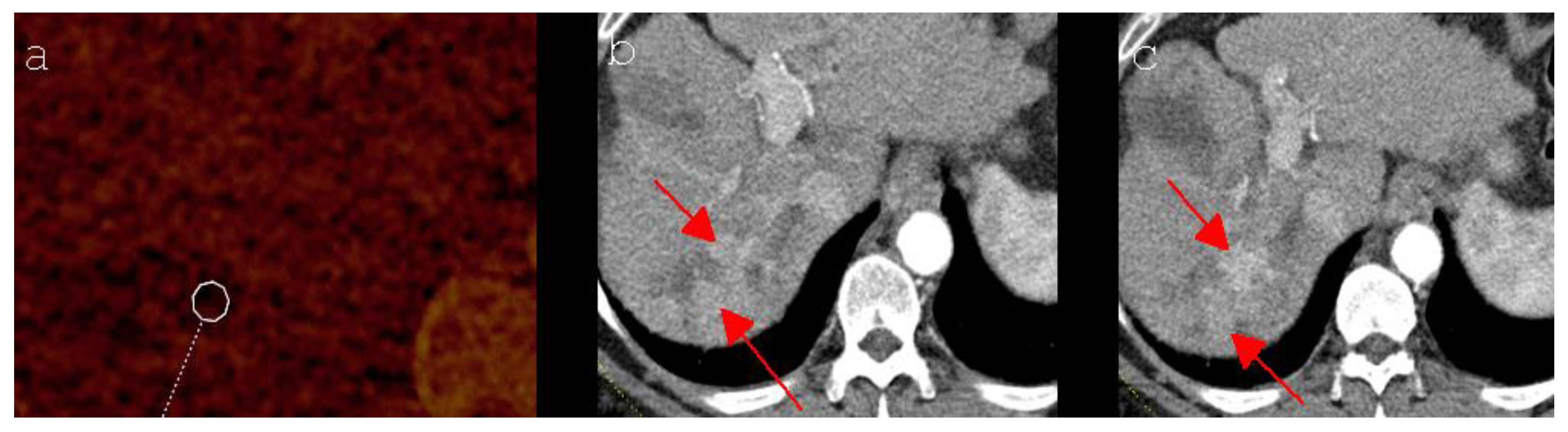 Diagnostics 12 00986 g002 550