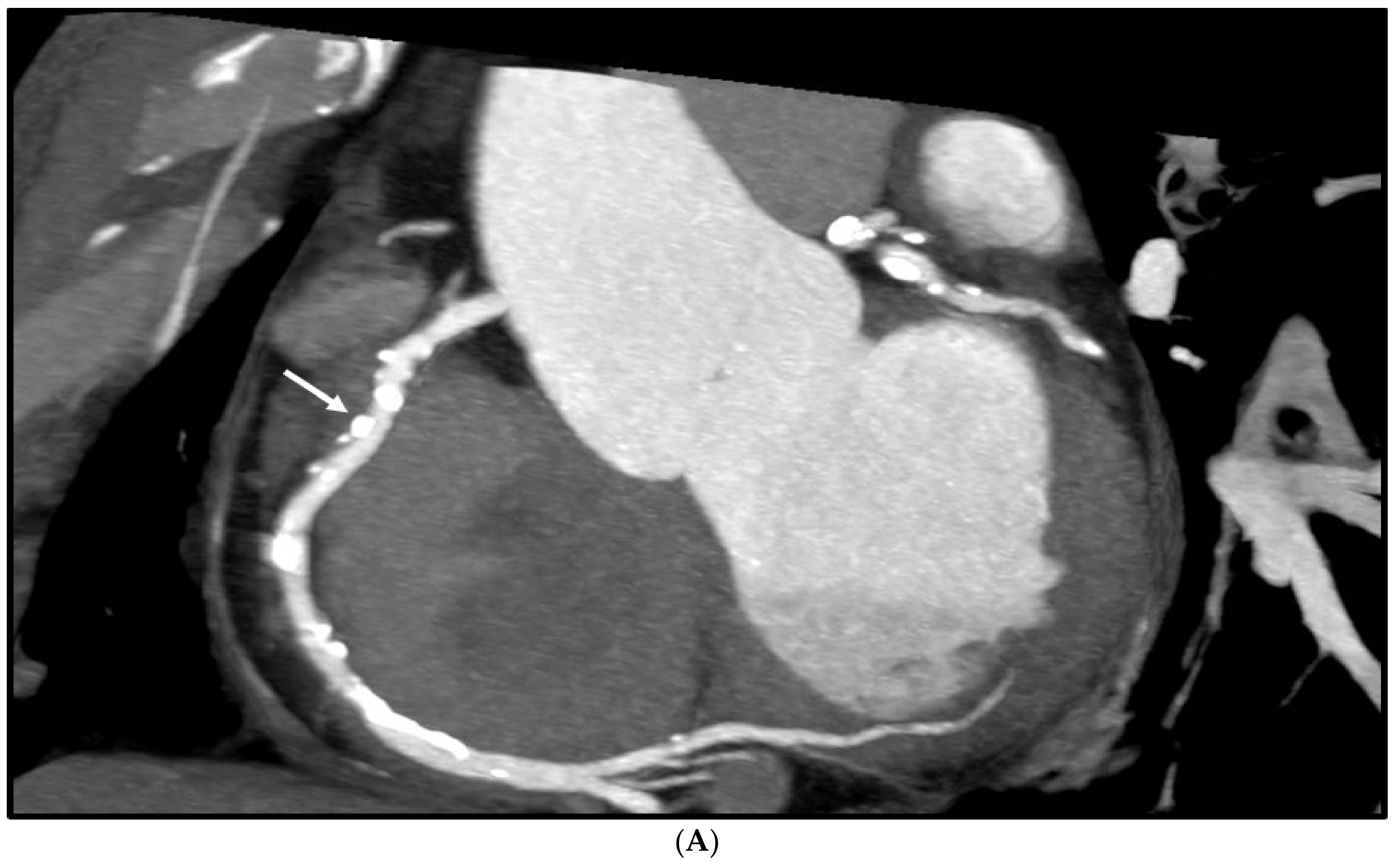 Diagnostics 12 00991 g005a