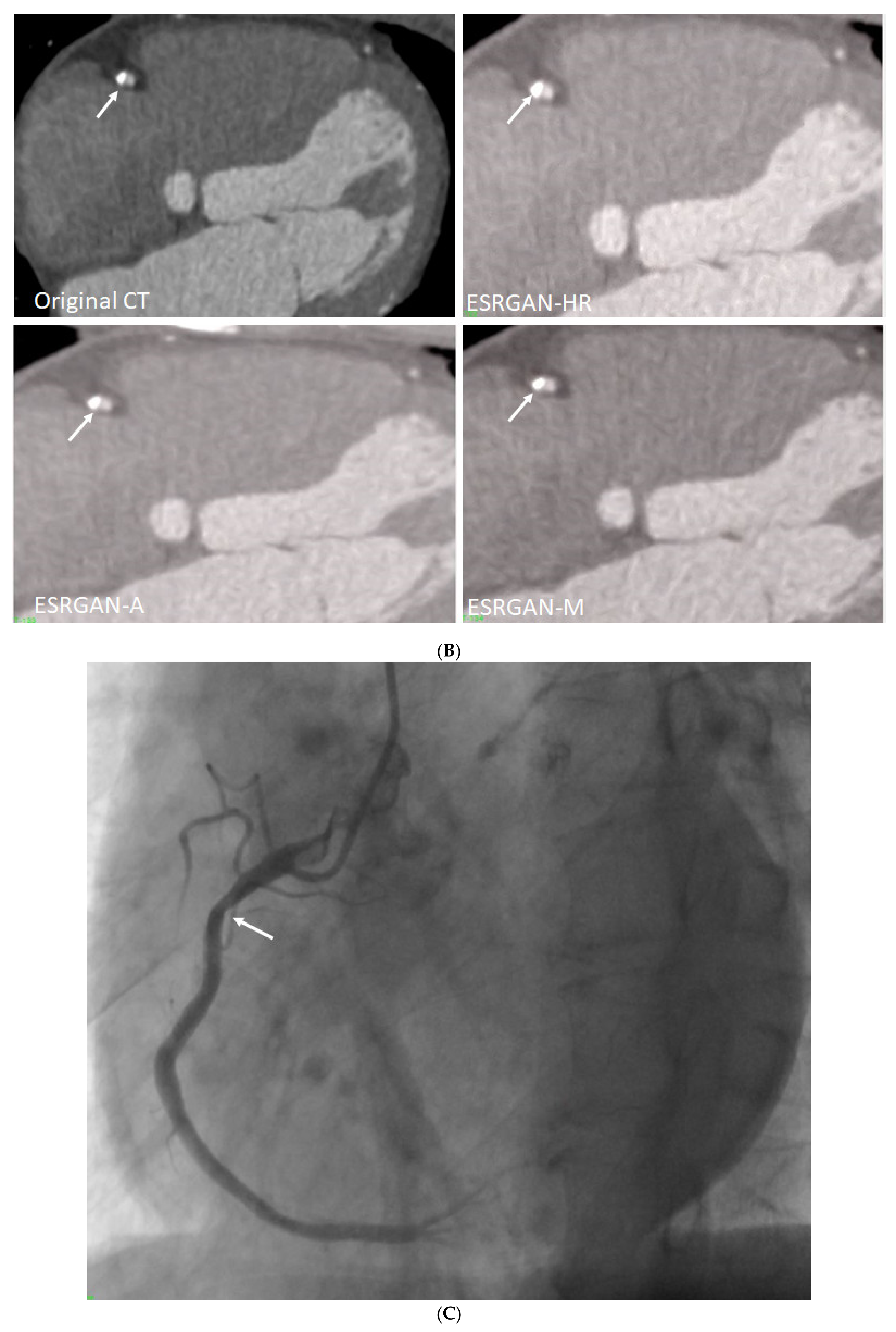 Diagnostics 12 00991 g005b