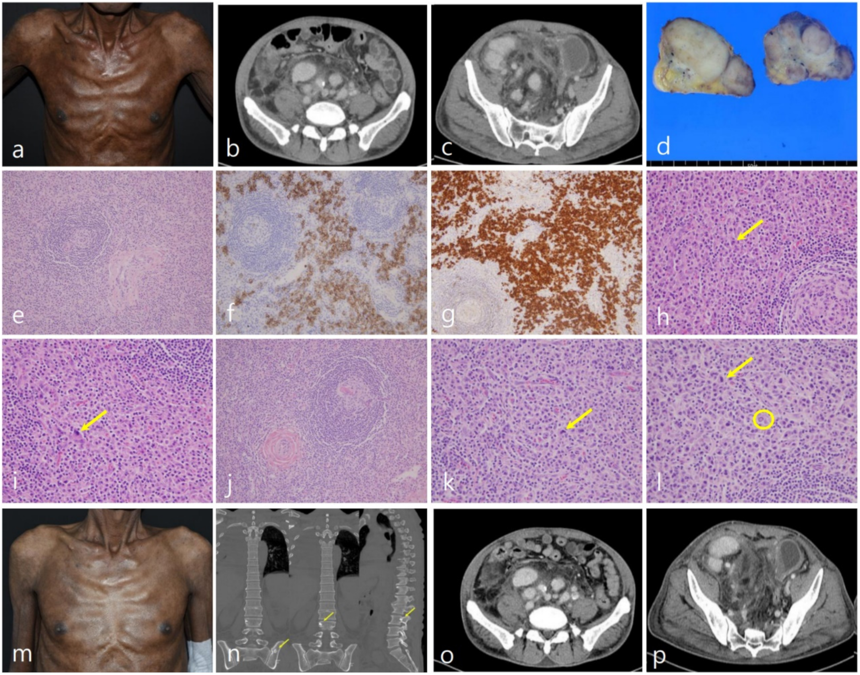 Diagnostics 12 00998 g001