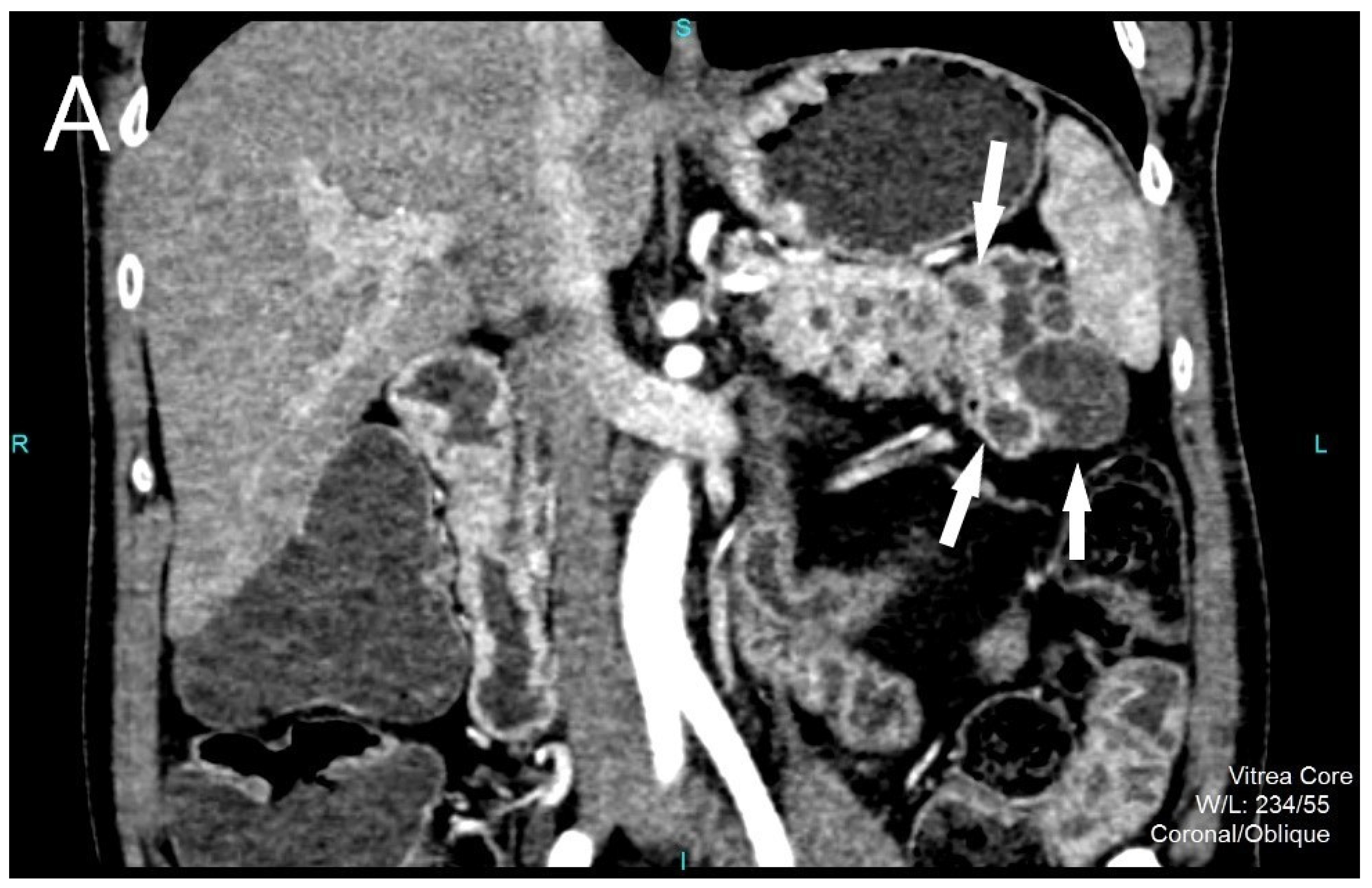 Diagnostics 12 01003 g001a Diagnostics 12 01003 g001a