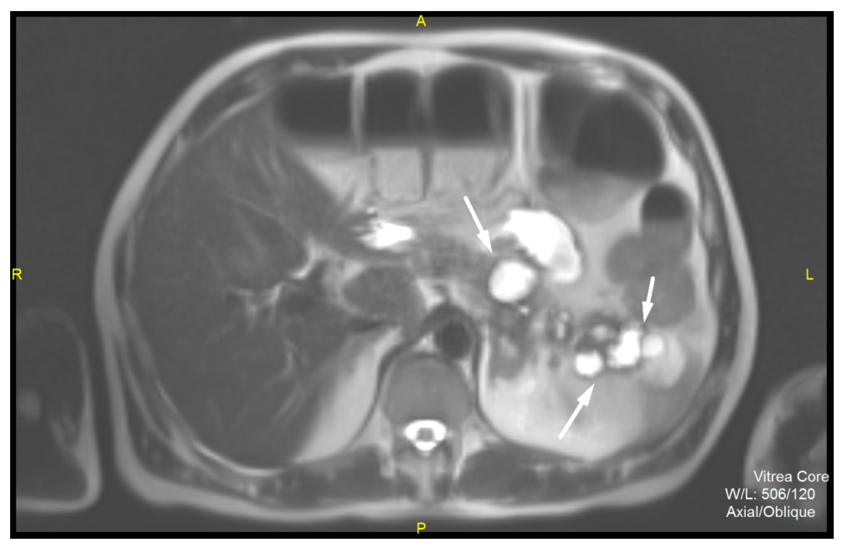 Diagnostics 12 01003 g003 Diagnostics 12 01003 g003