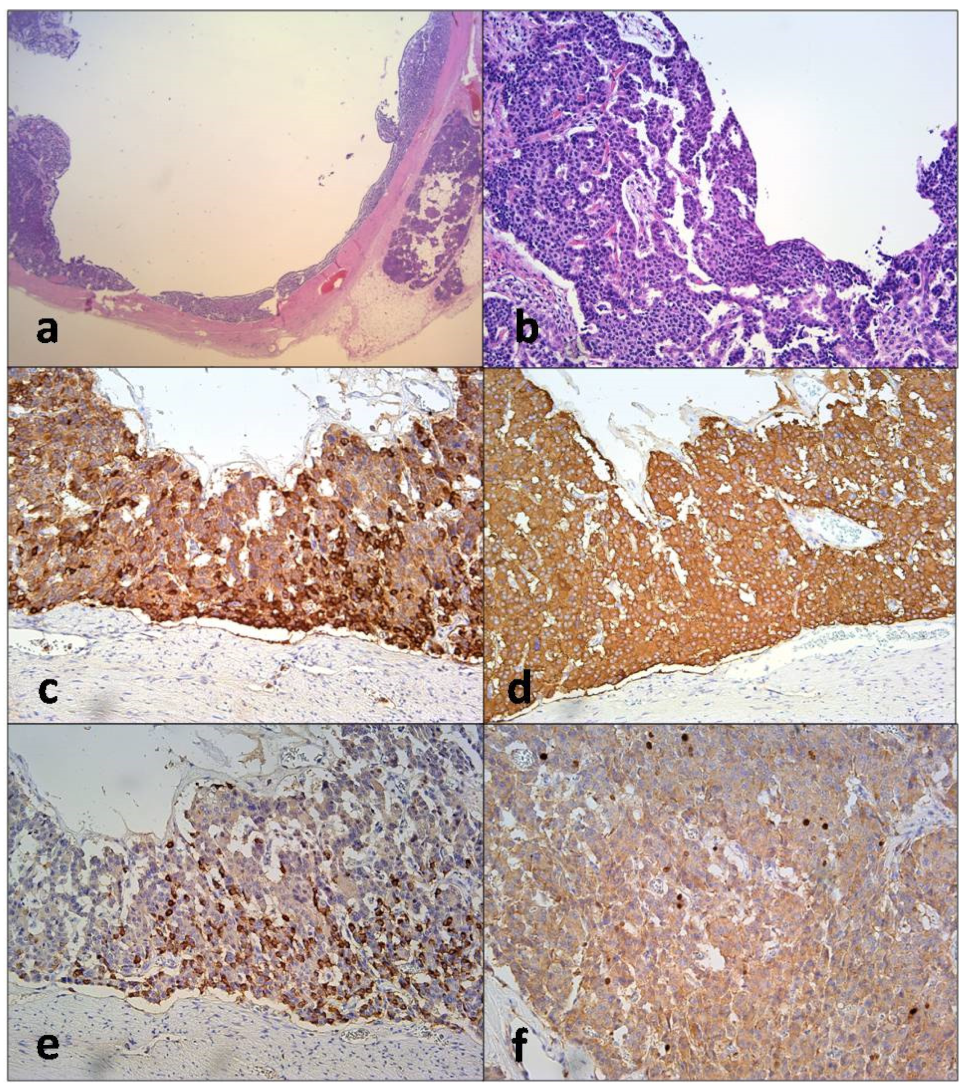 Diagnostics 12 01003 g005 Diagnostics 12 01003 g005