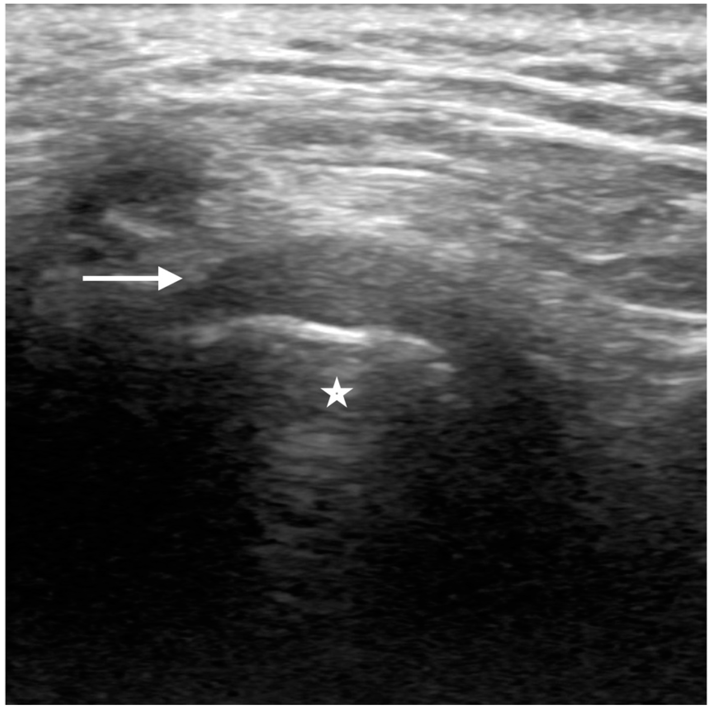 Diagnostics 12 01006 g003 550