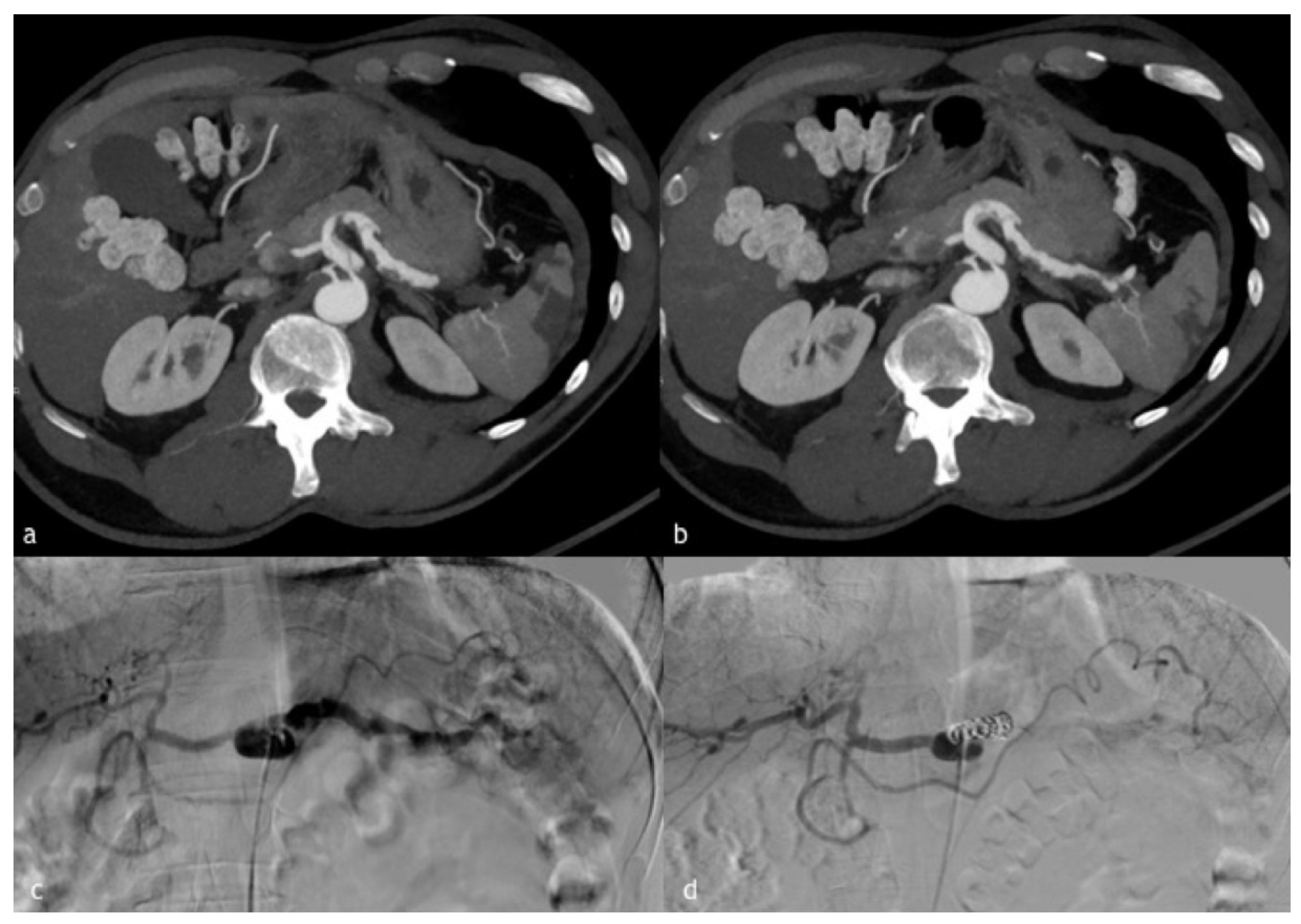 Diagnostics 12 01012 g004