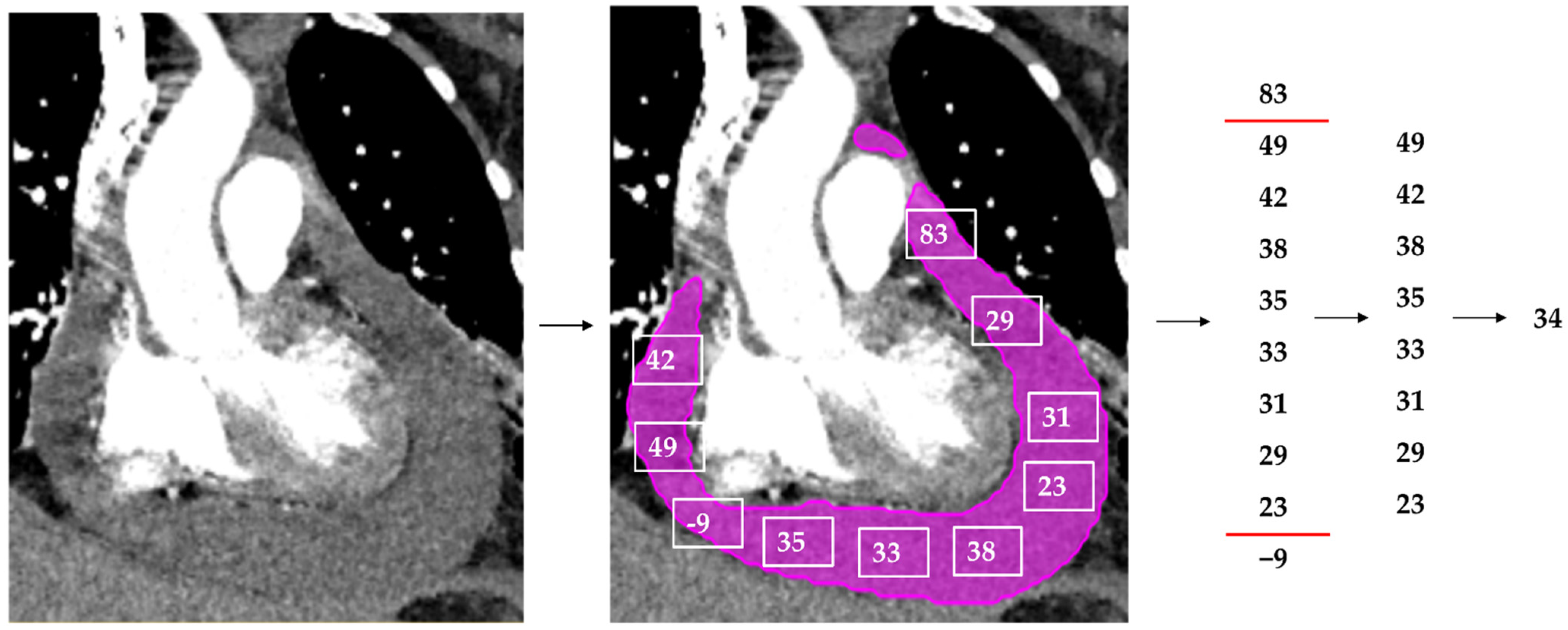Diagnostics 12 01045 g002 550