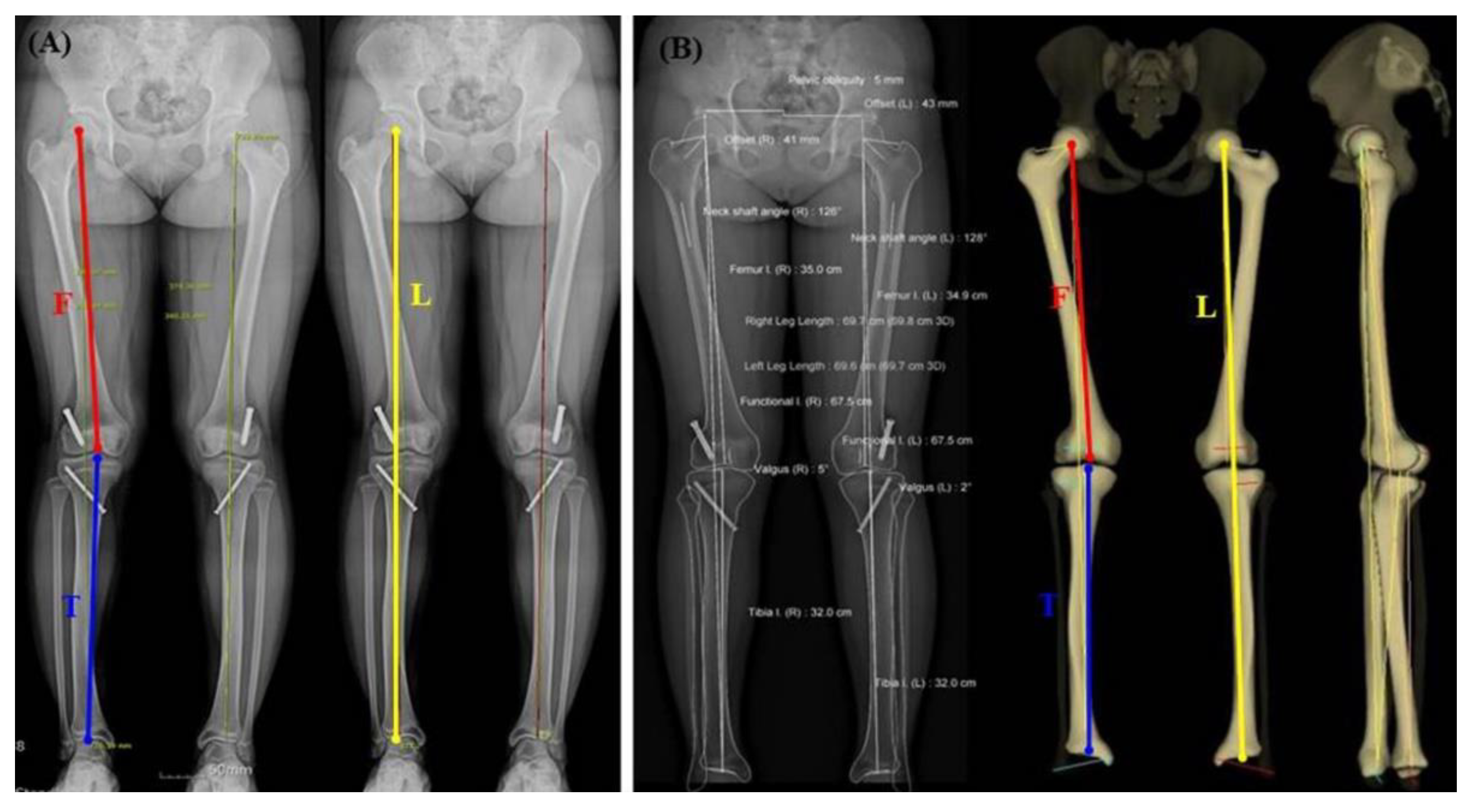 Leg l. How to measure length Legs. Lowerbody Sizes. Inside Leg length inch. Discrepancy.