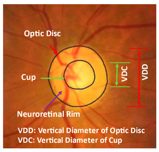 Diagnostics Free FullText Identifying Those at Risk of A