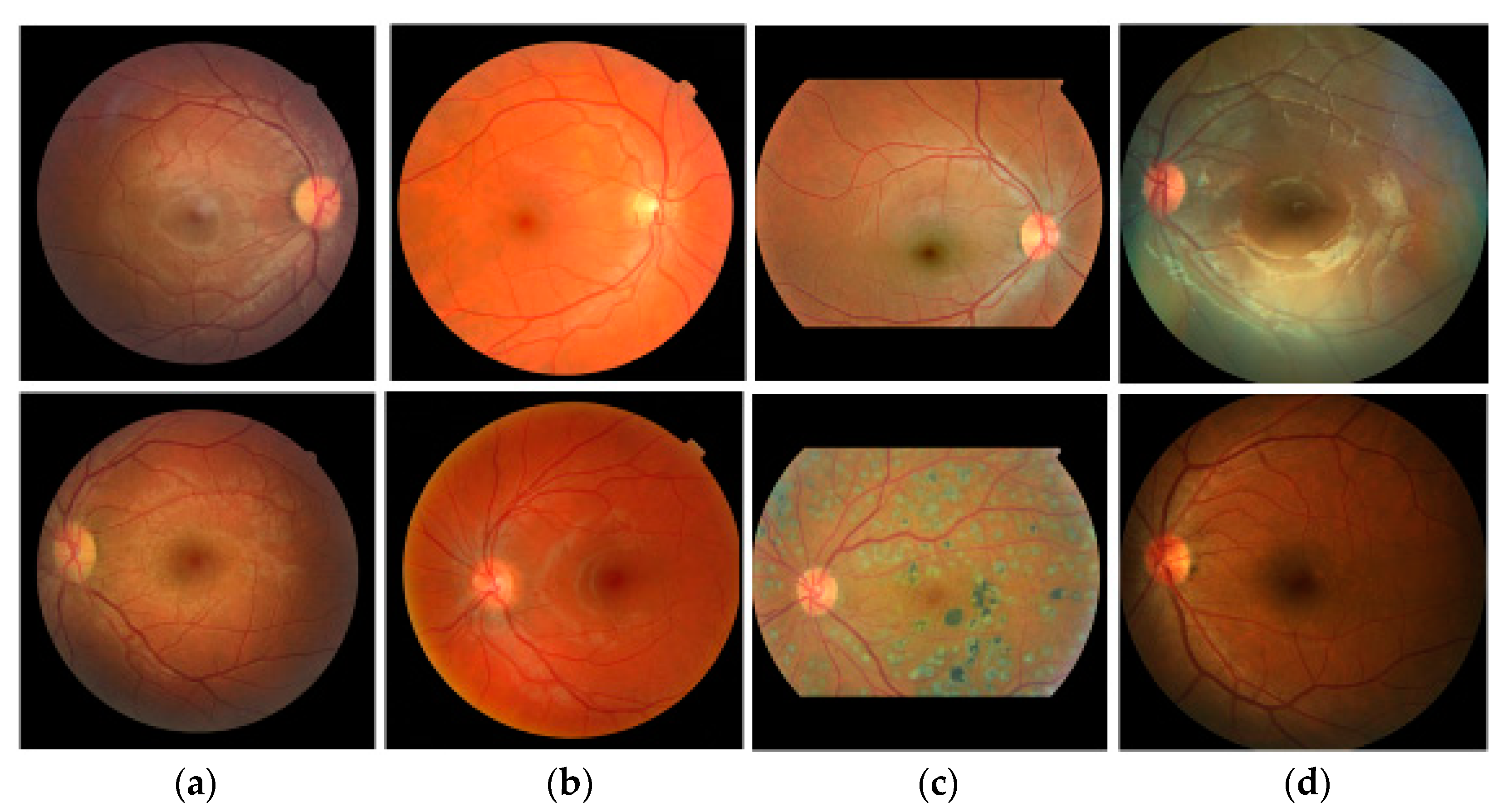 Diagnostics 12 01063 g002 550