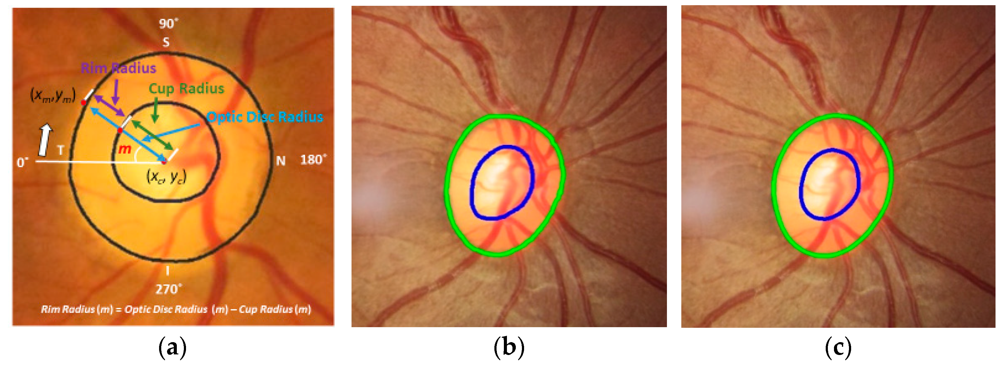 Diagnostics Free FullText Identifying Those at Risk of A