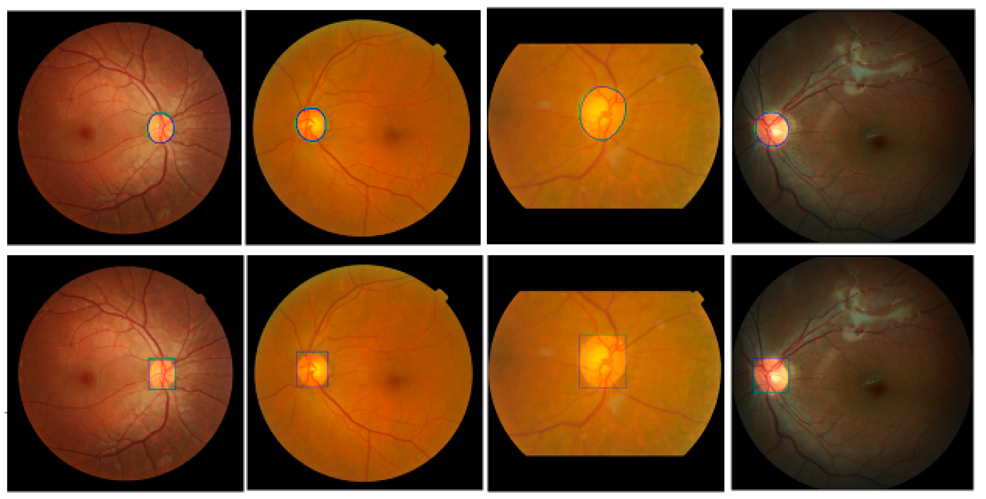 Diagnostics 12 01063 g008 550