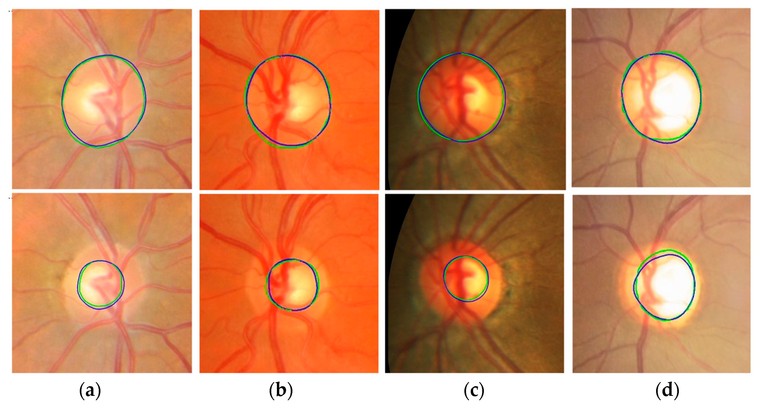 Diagnostics 12 01063 g011a 550