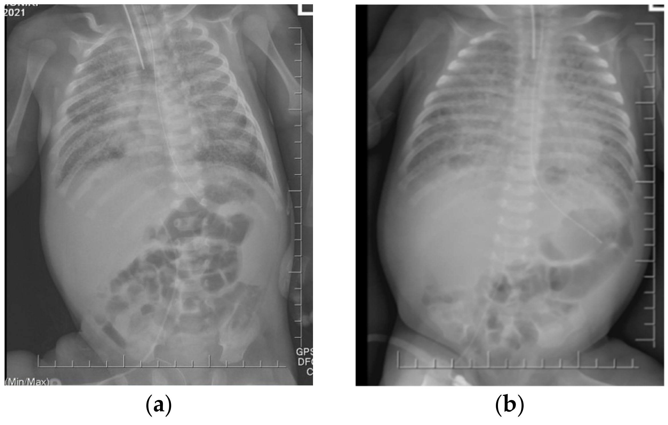 Diagnostics 12 01084 g002 Diagnostics 12 01084 g002