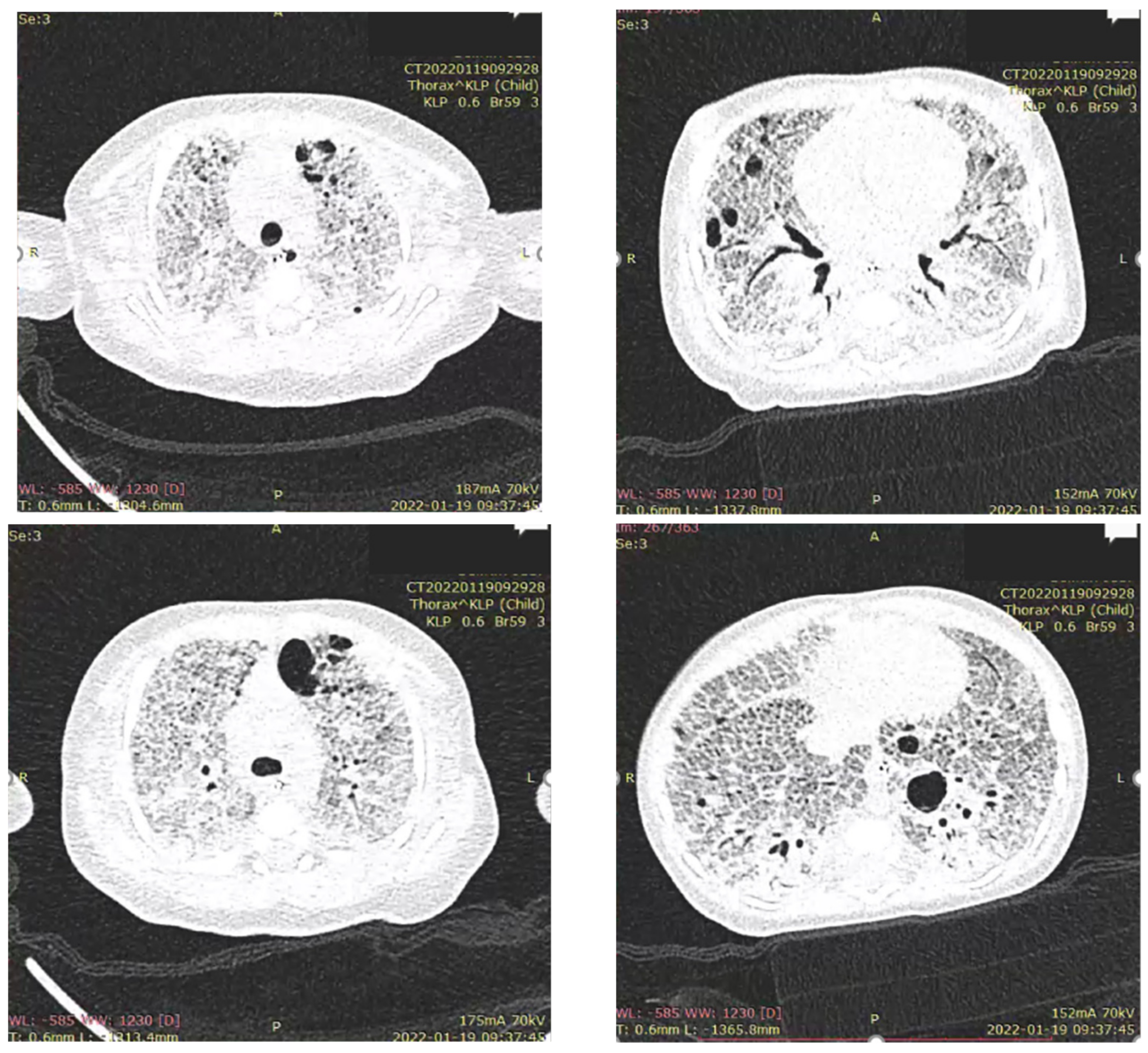 Diagnostics 12 01084 g003 Diagnostics 12 01084 g003