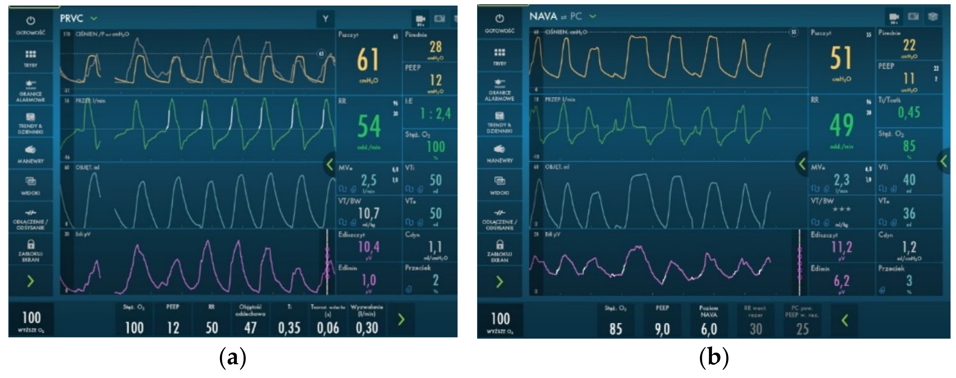 Diagnostics 12 01084 g004 Diagnostics 12 01084 g004