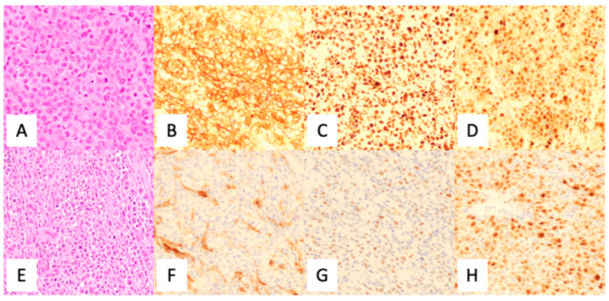 Diagnostics 12 01087 g004
