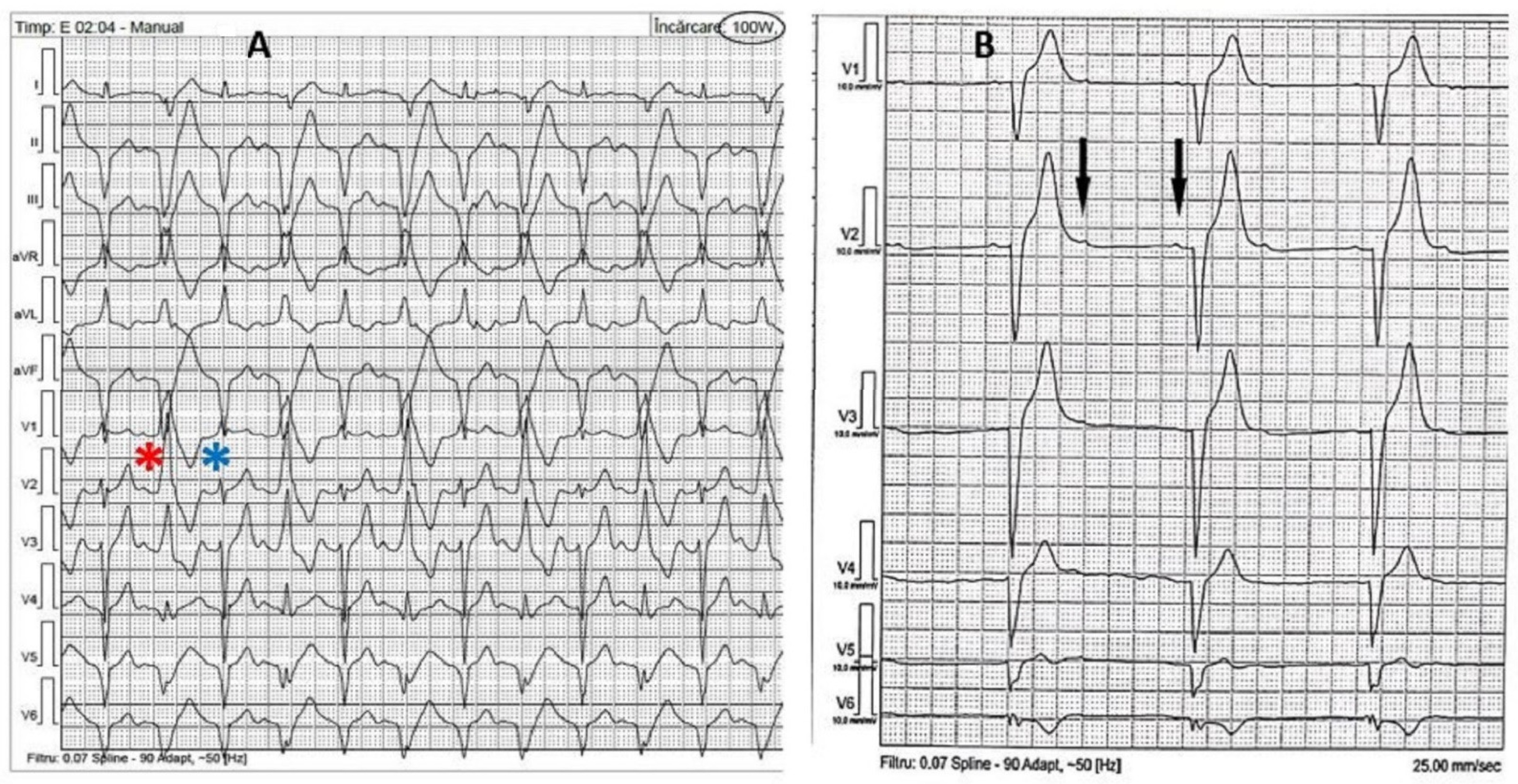 Diagnostics 12 01096 g004 550