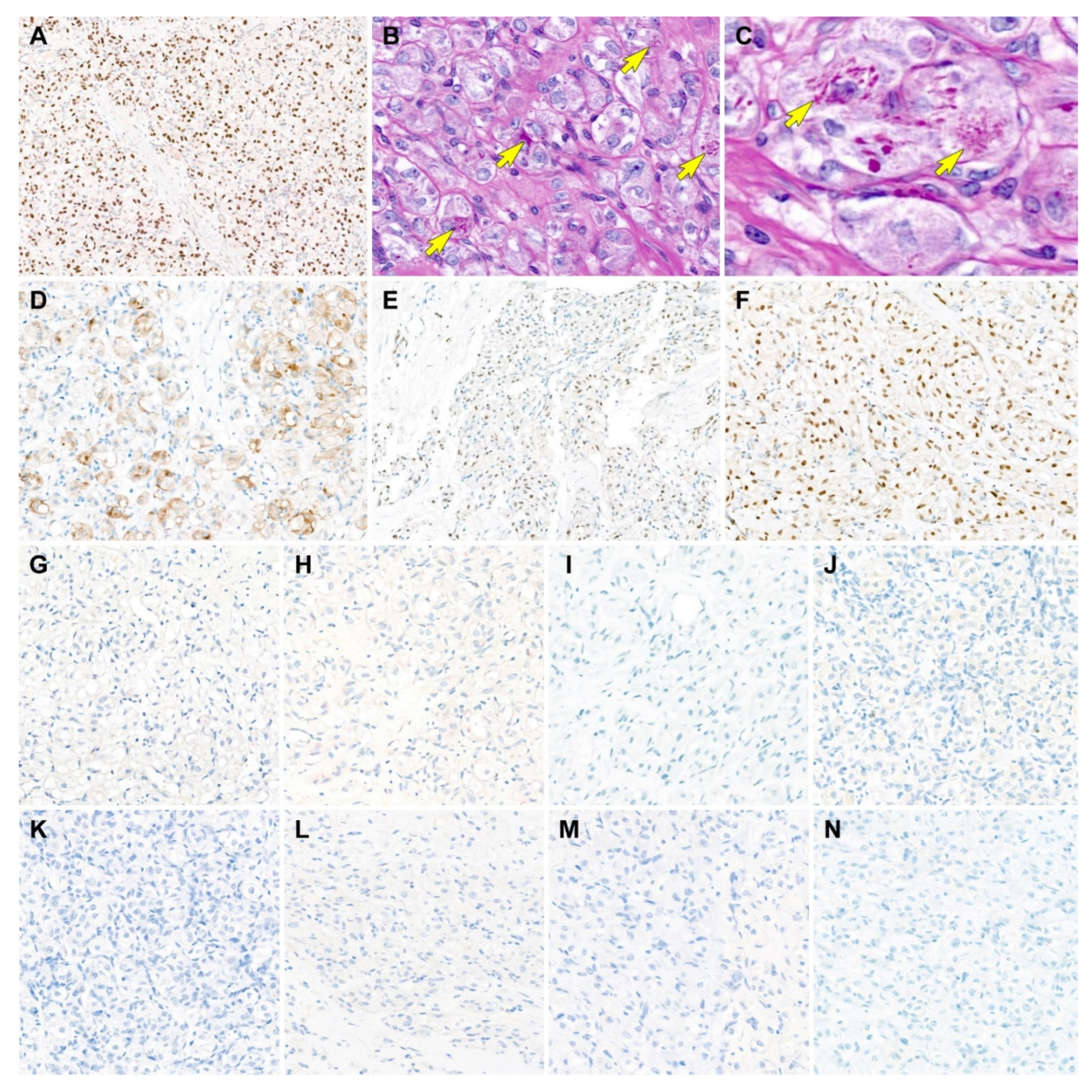 Diagnostics 12 01102 g003 550
