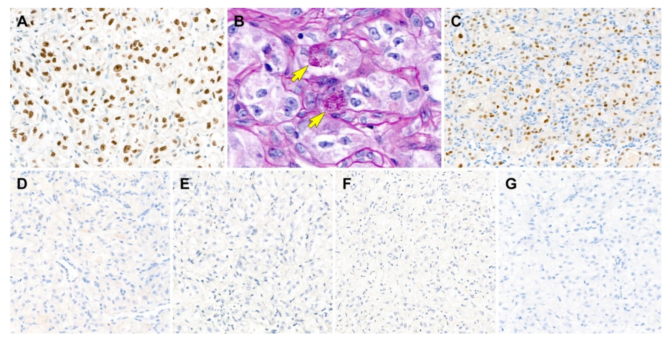 Diagnostics 12 01102 g006 550
