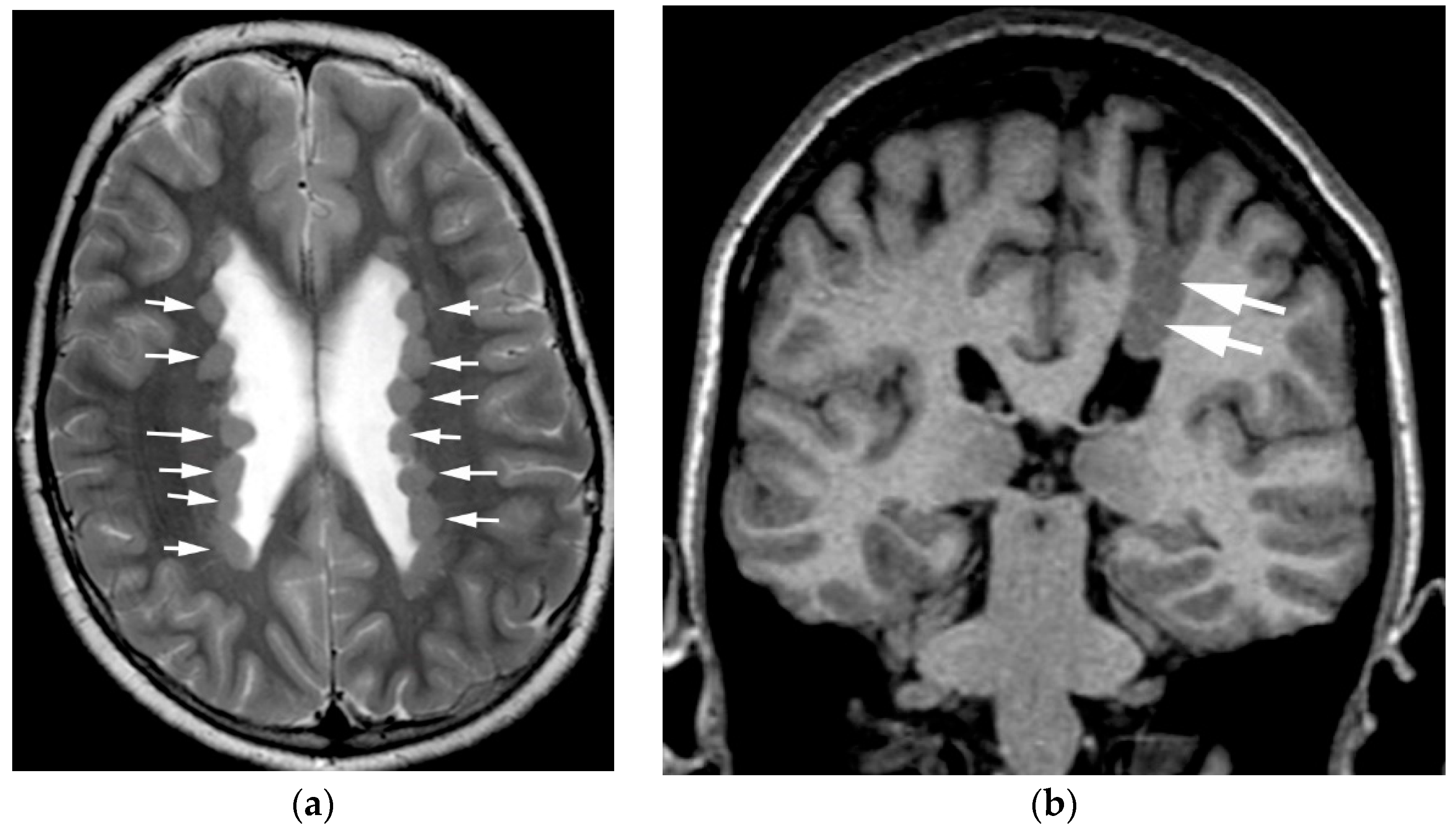 Diagnostics 12 01123 g003 550