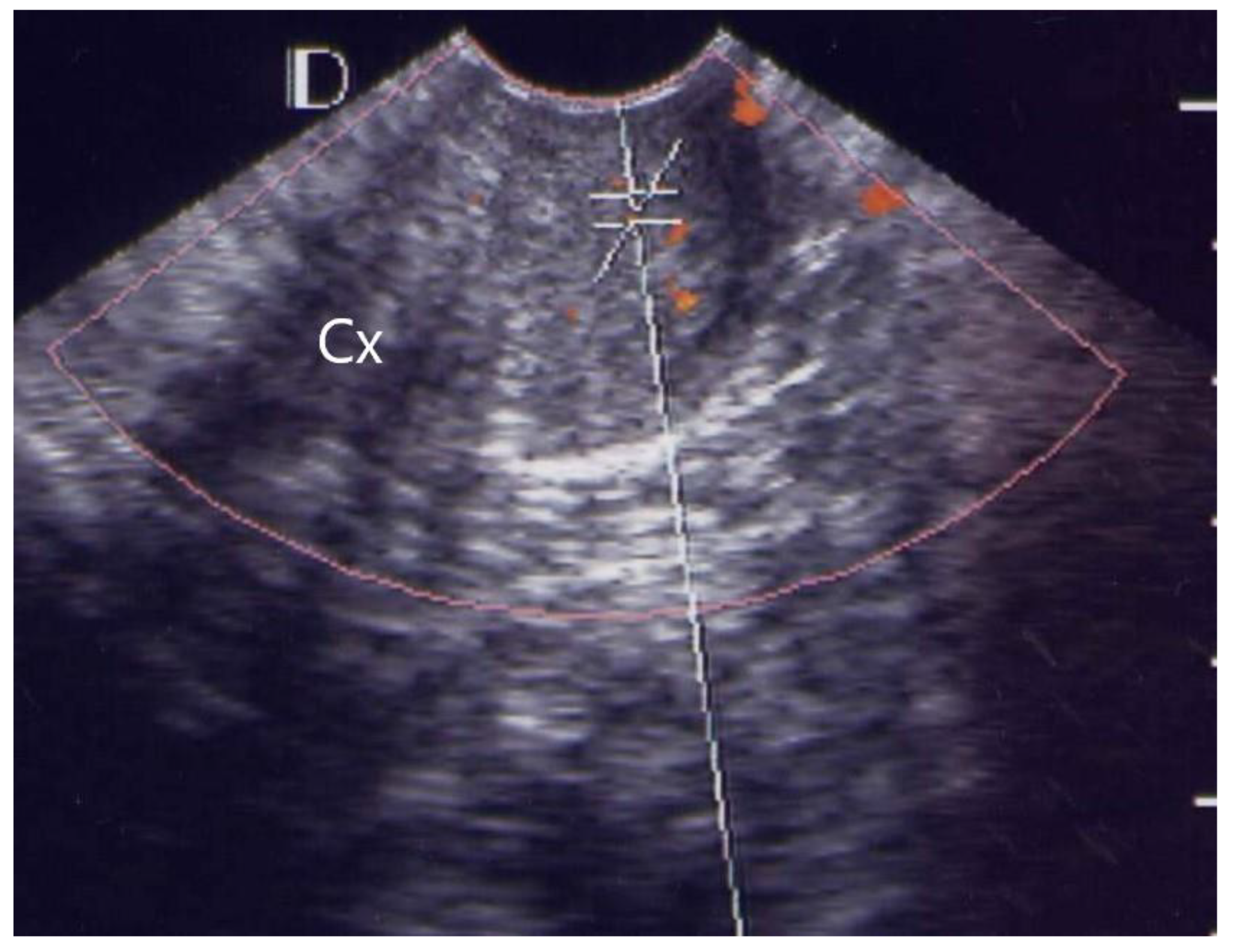 Diagnostics Free FullText Cervical Power Doppler Angiography with