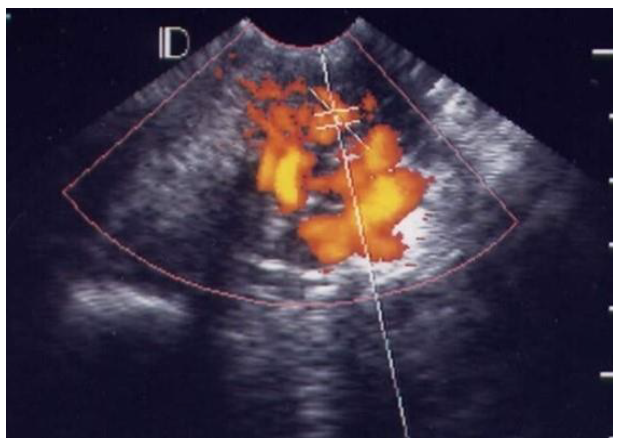 Diagnostics 12 01131 g004