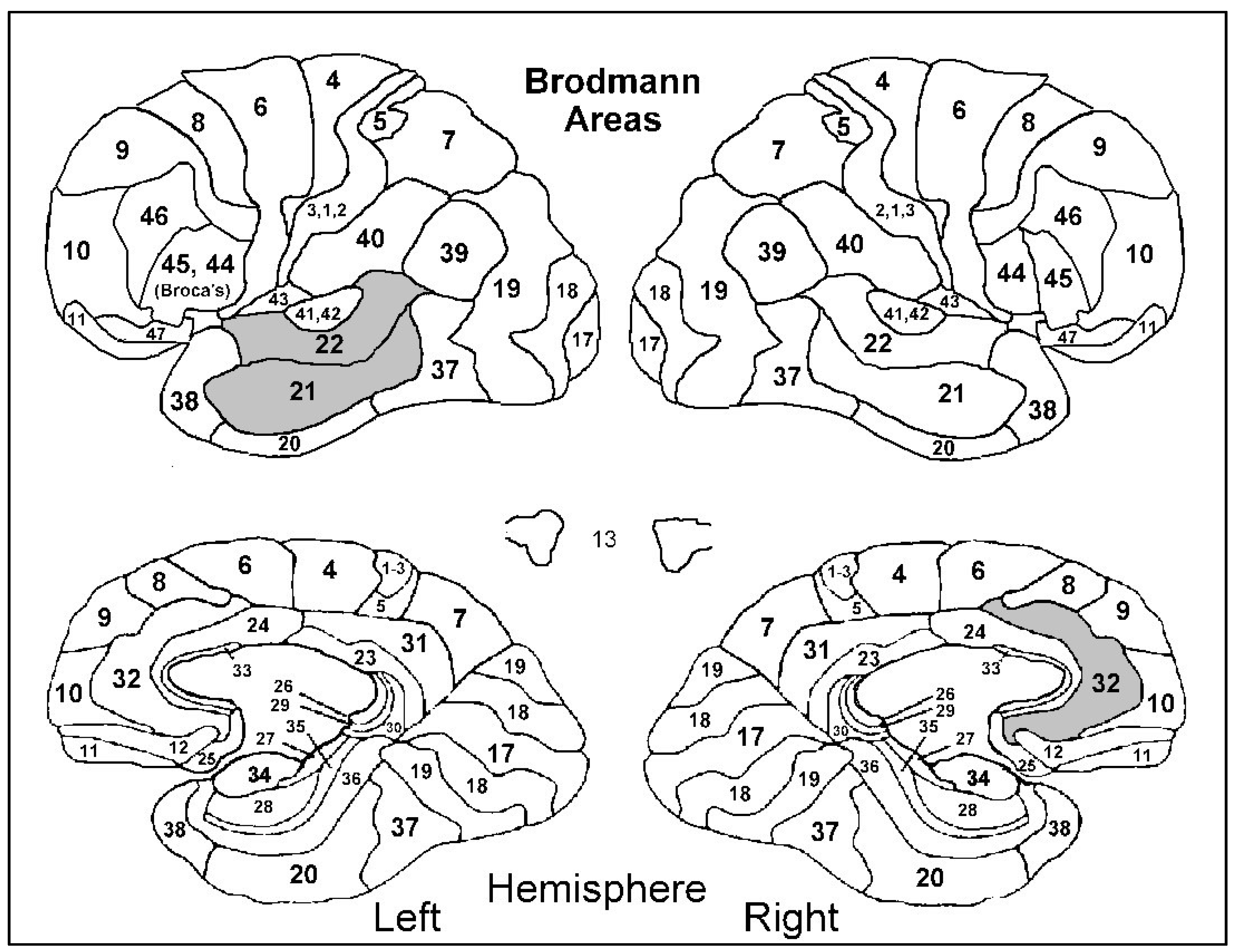 Diagnostics Free Full Text Anosognosia In Dementia Evaluation Of Perfusion Correlates Using 99mtc Hmpao Spect And Automated Brodmann Areas Analysis Html