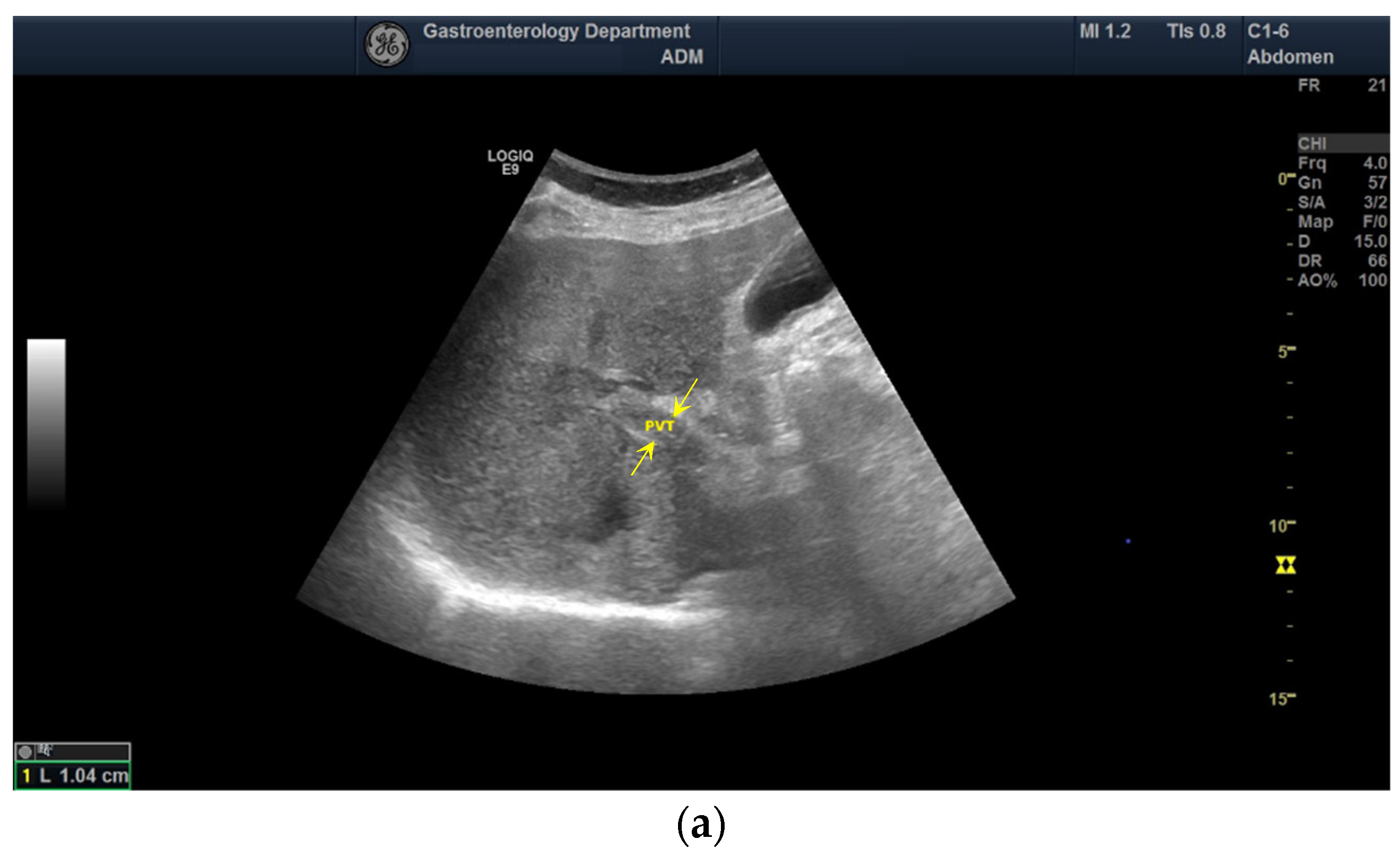 Diagnostics 12 01145 g001a 550