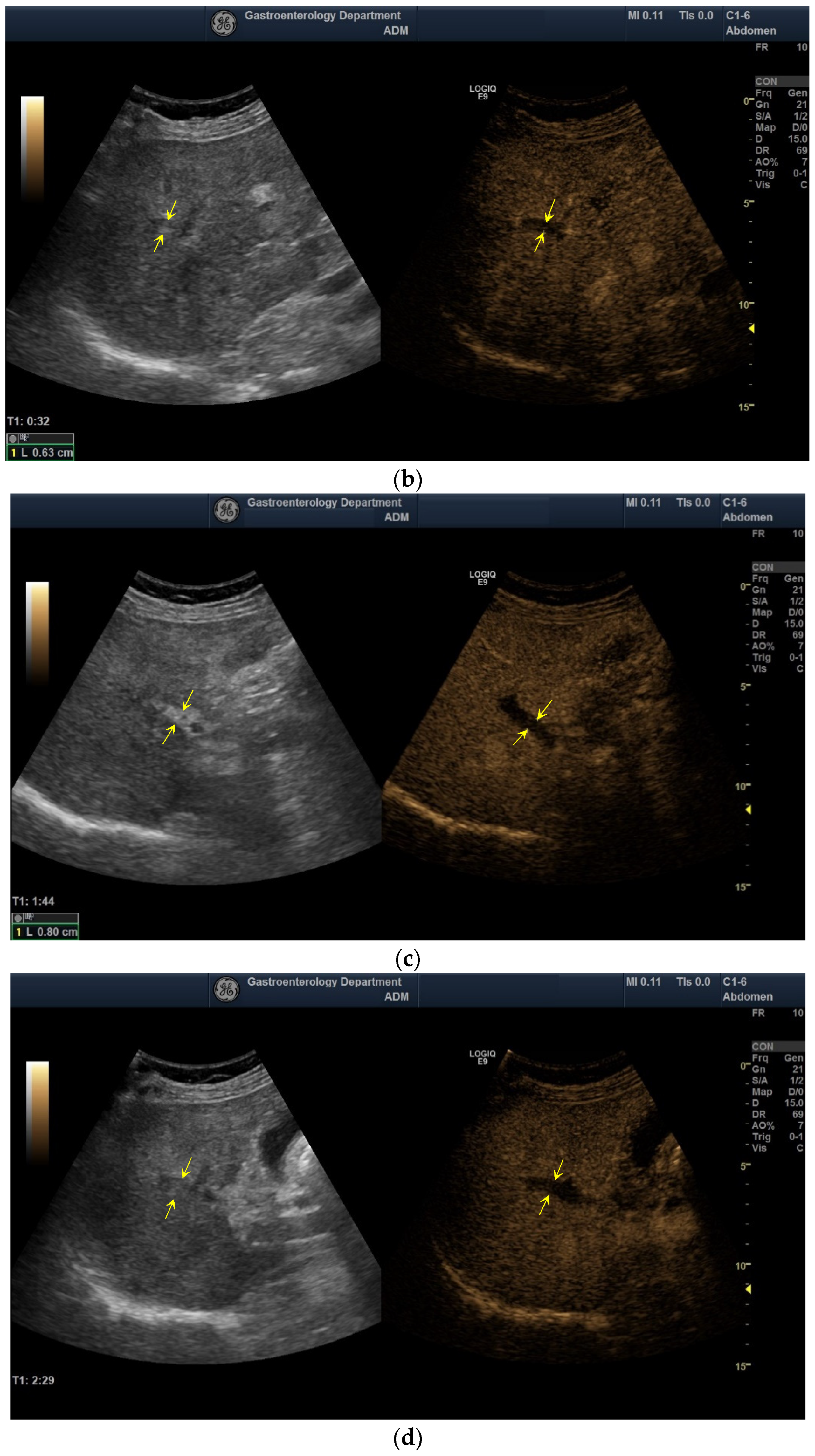 Diagnostics 12 01145 g001b 550