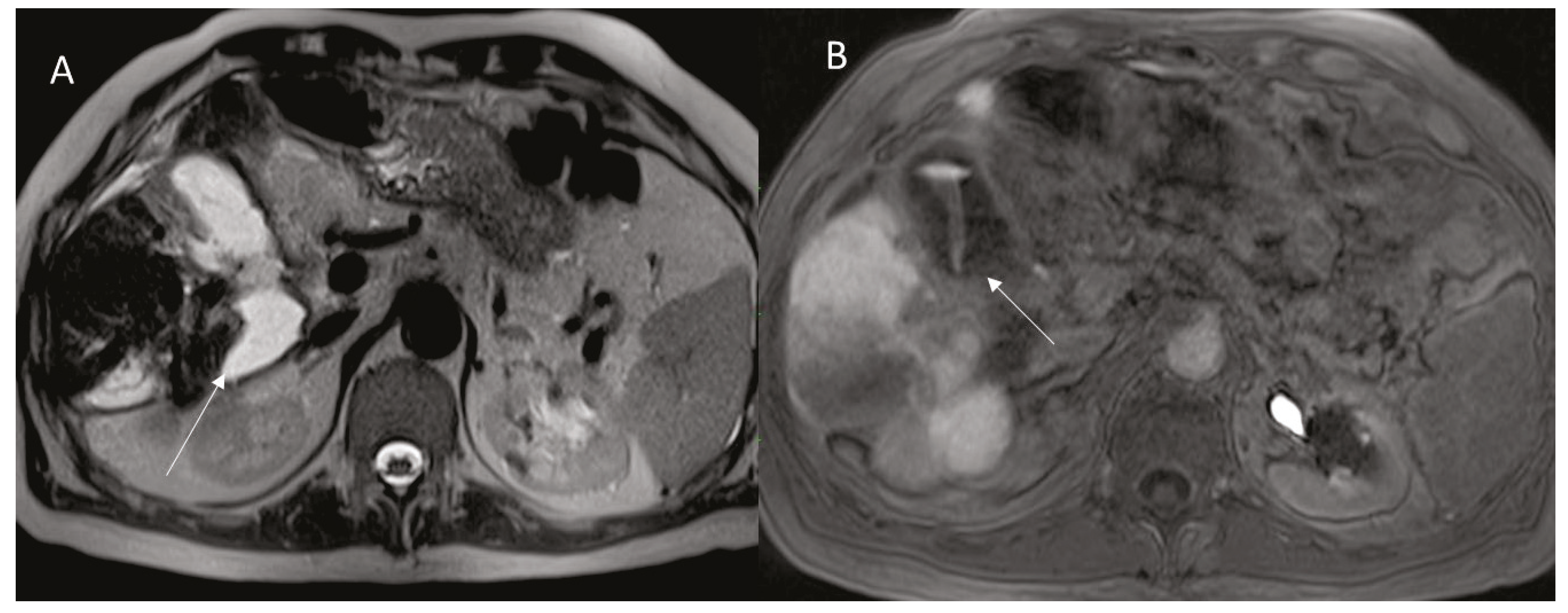 Diagnostics 12 01151 g004