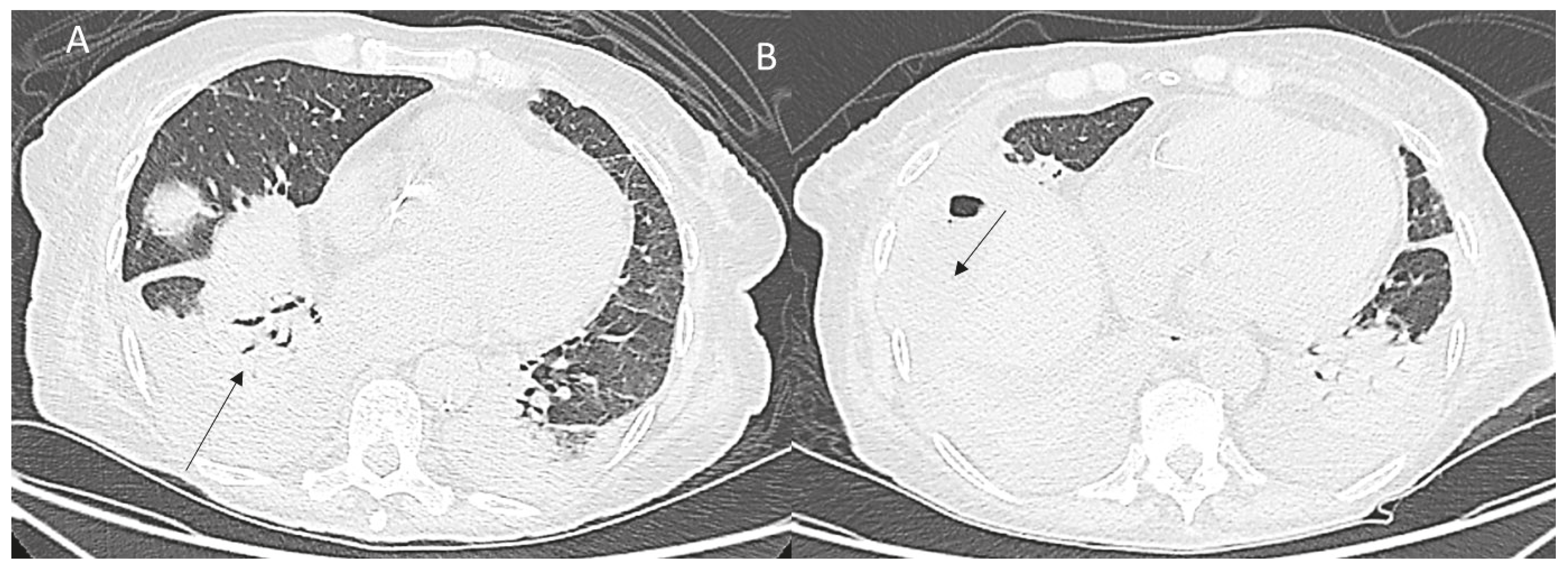 Diagnostics 12 01151 g006