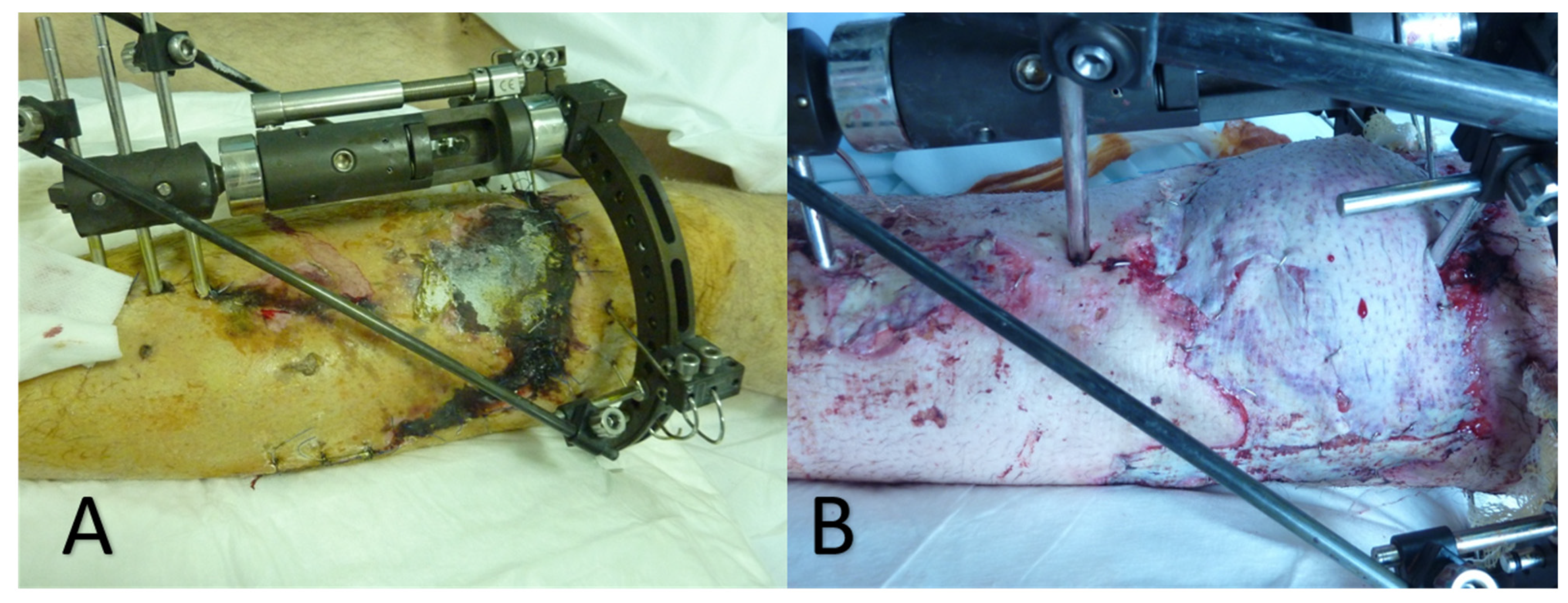 Diagnostics 12 01163 g001