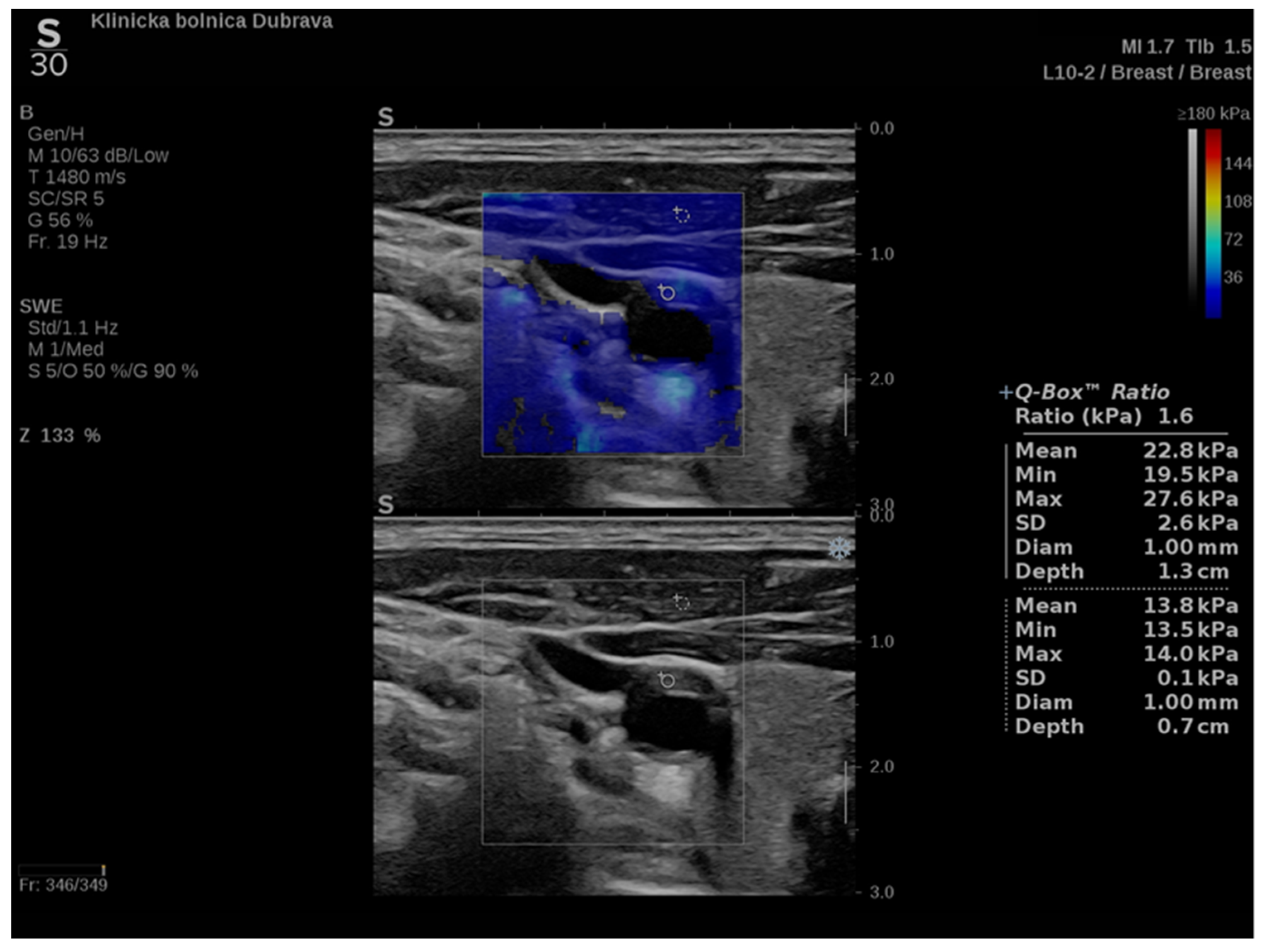 Diagnostics 12 01168 g002 550