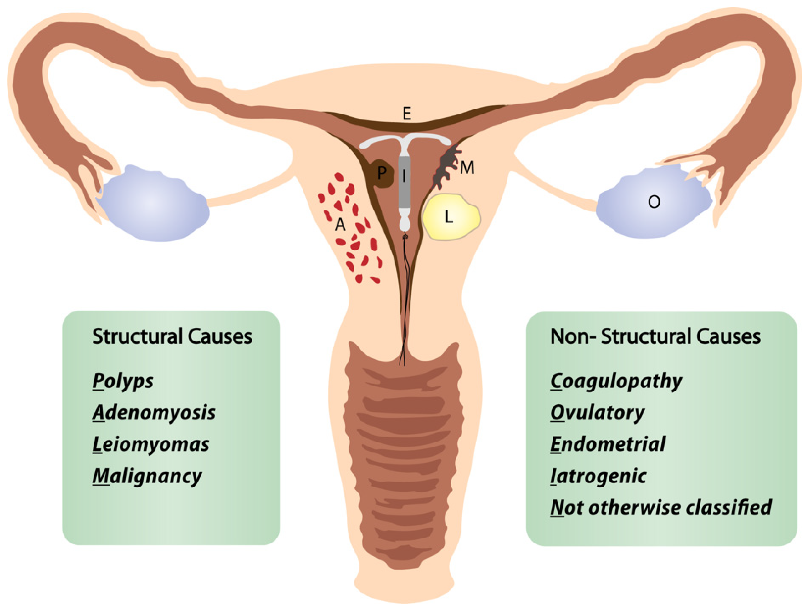 Menopause and Bleeding After Menopause