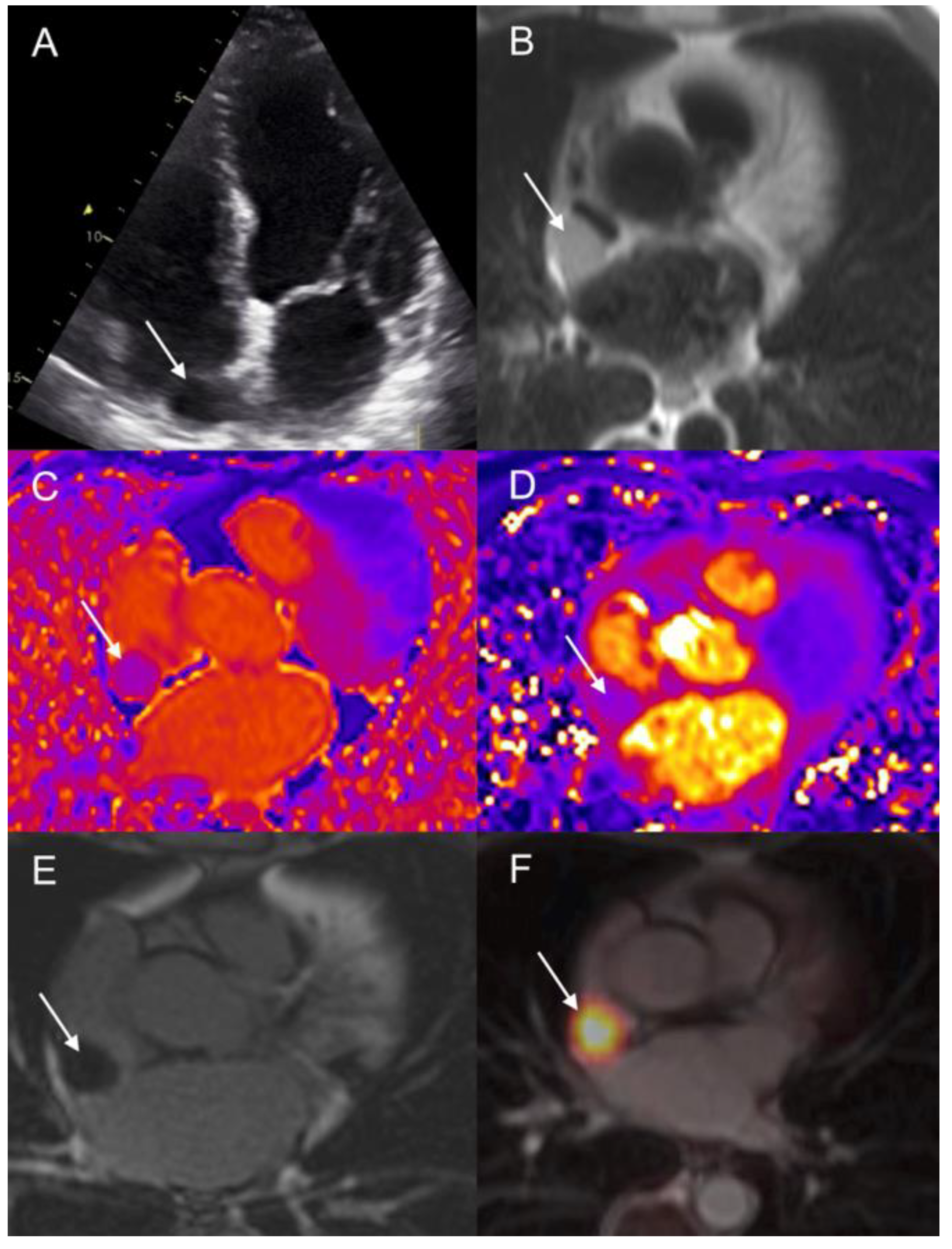 Diagnostics 12 01182 g008 Diagnostics 12 01182 g008