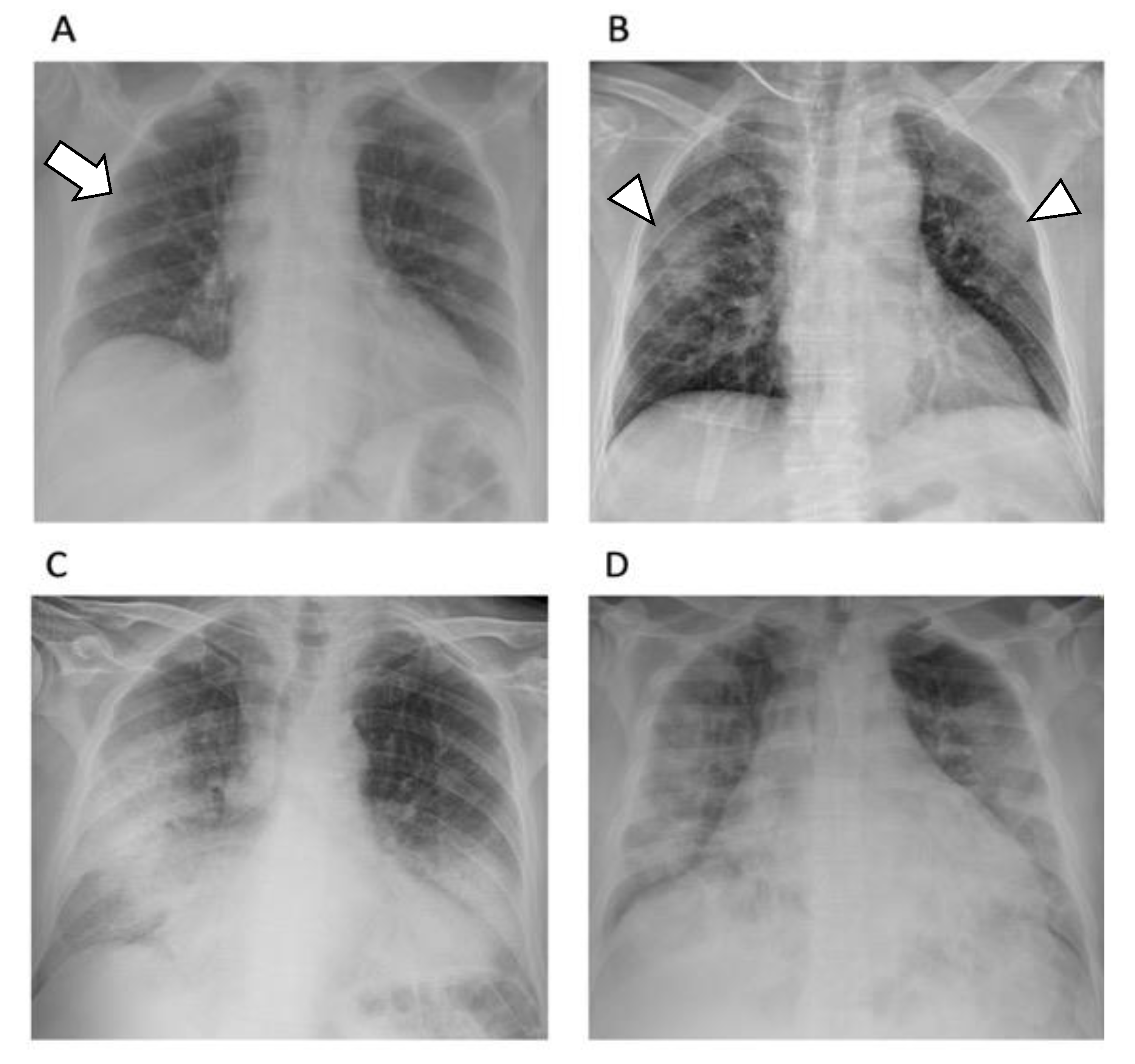 Diagnostics 12 01188 g003 550