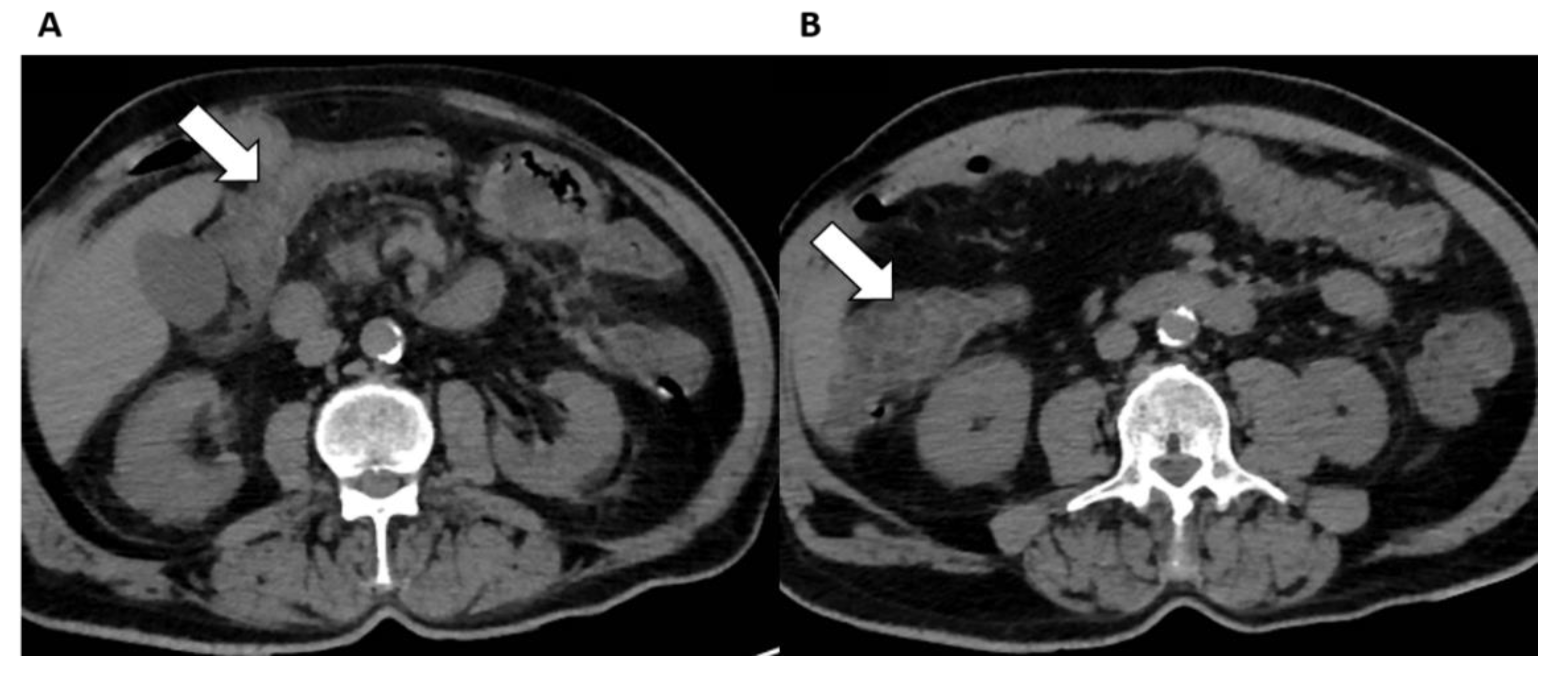 Diagnostics 12 01188 g005 550