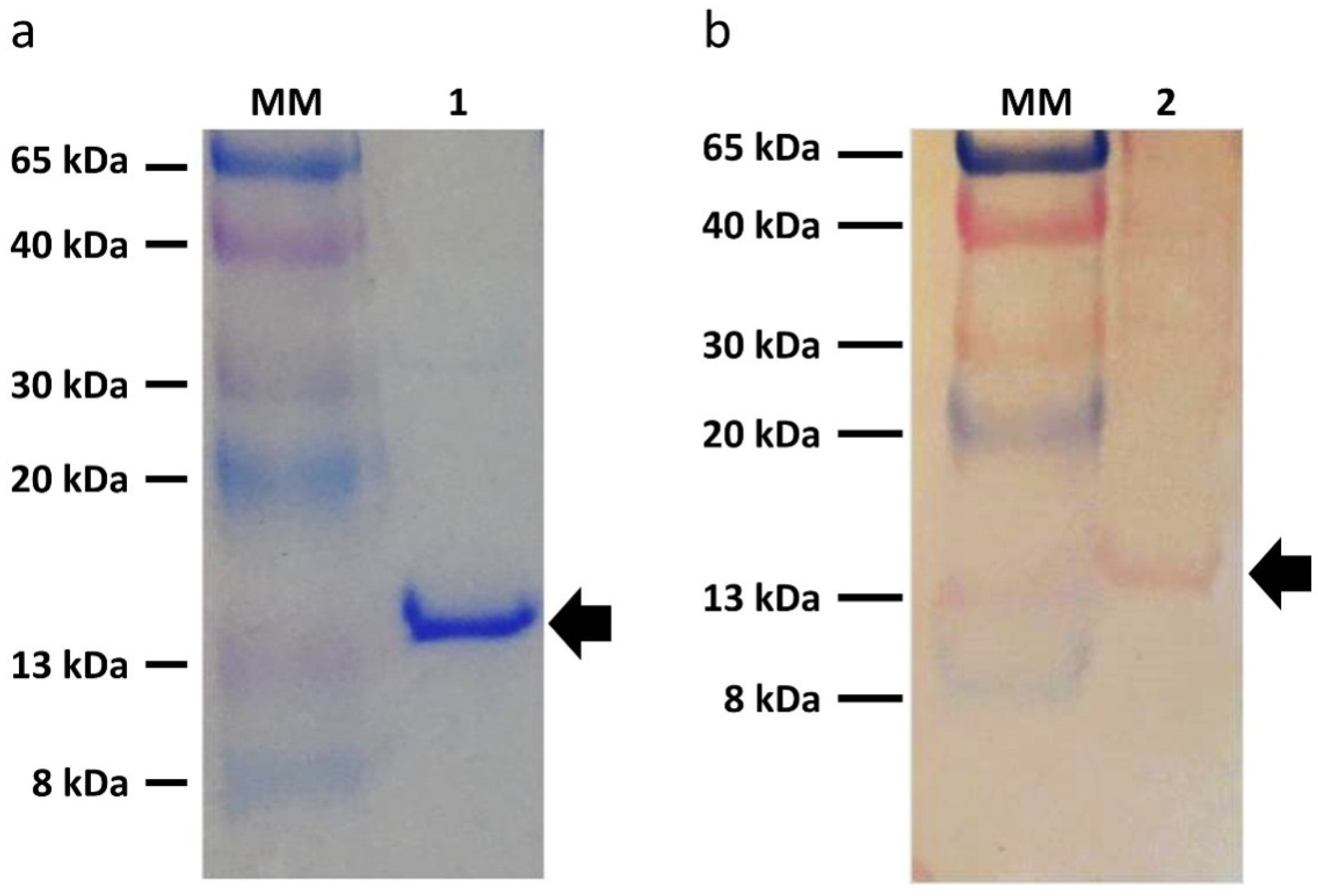 Diagnostics 12 01198 g003 Diagnostics 12 01198 g003