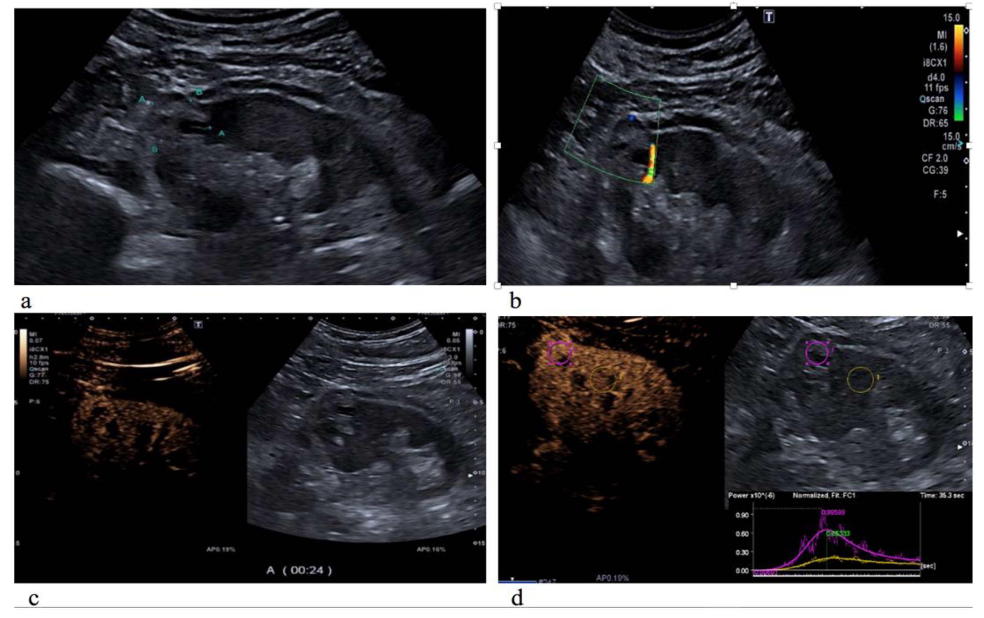 Diagnostics 12 01209 g001