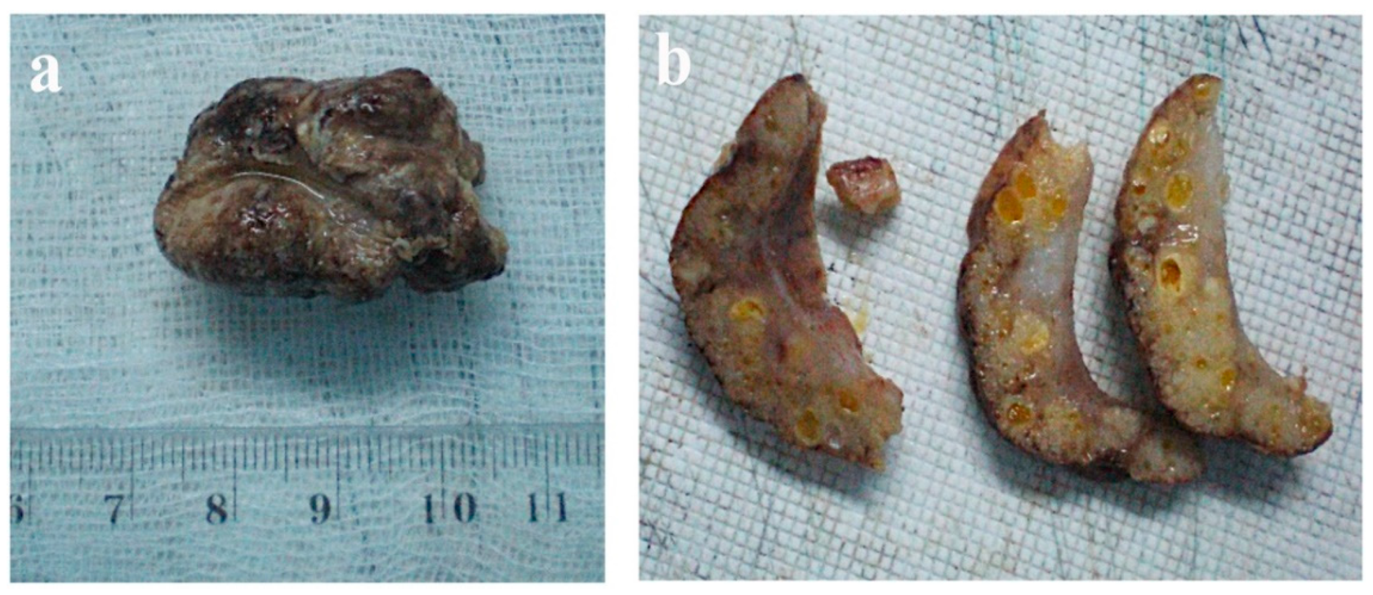 Diagnostics 12 01232 g002 550