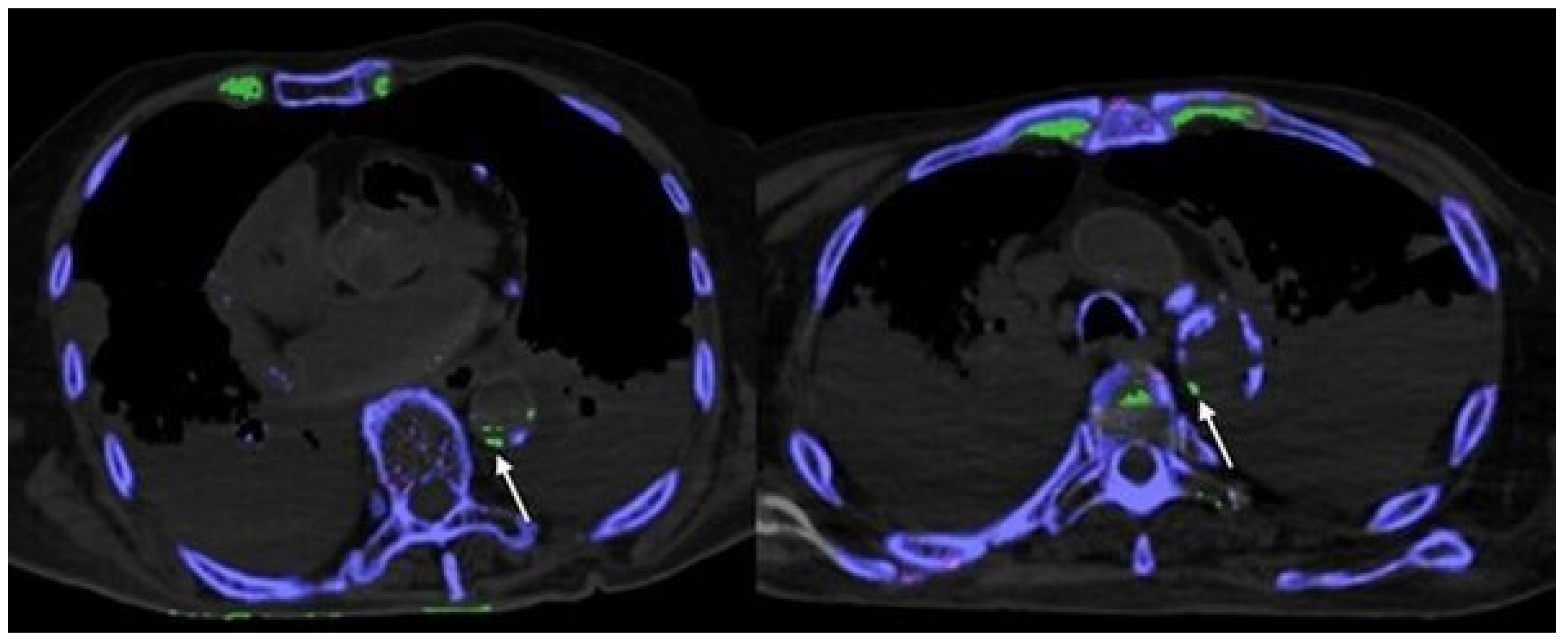 Diagnostics 12 01240 g002 Diagnostics 12 01240 g002