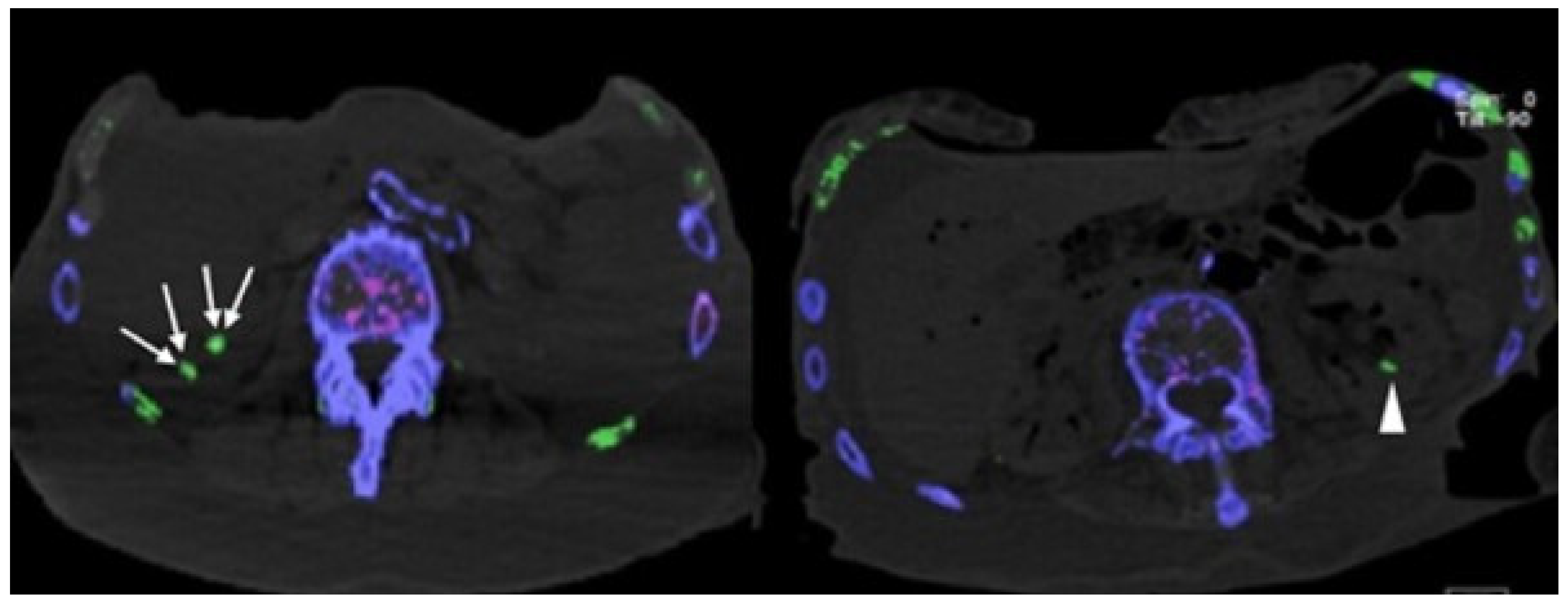 Diagnostics 12 01240 g004 Diagnostics 12 01240 g004