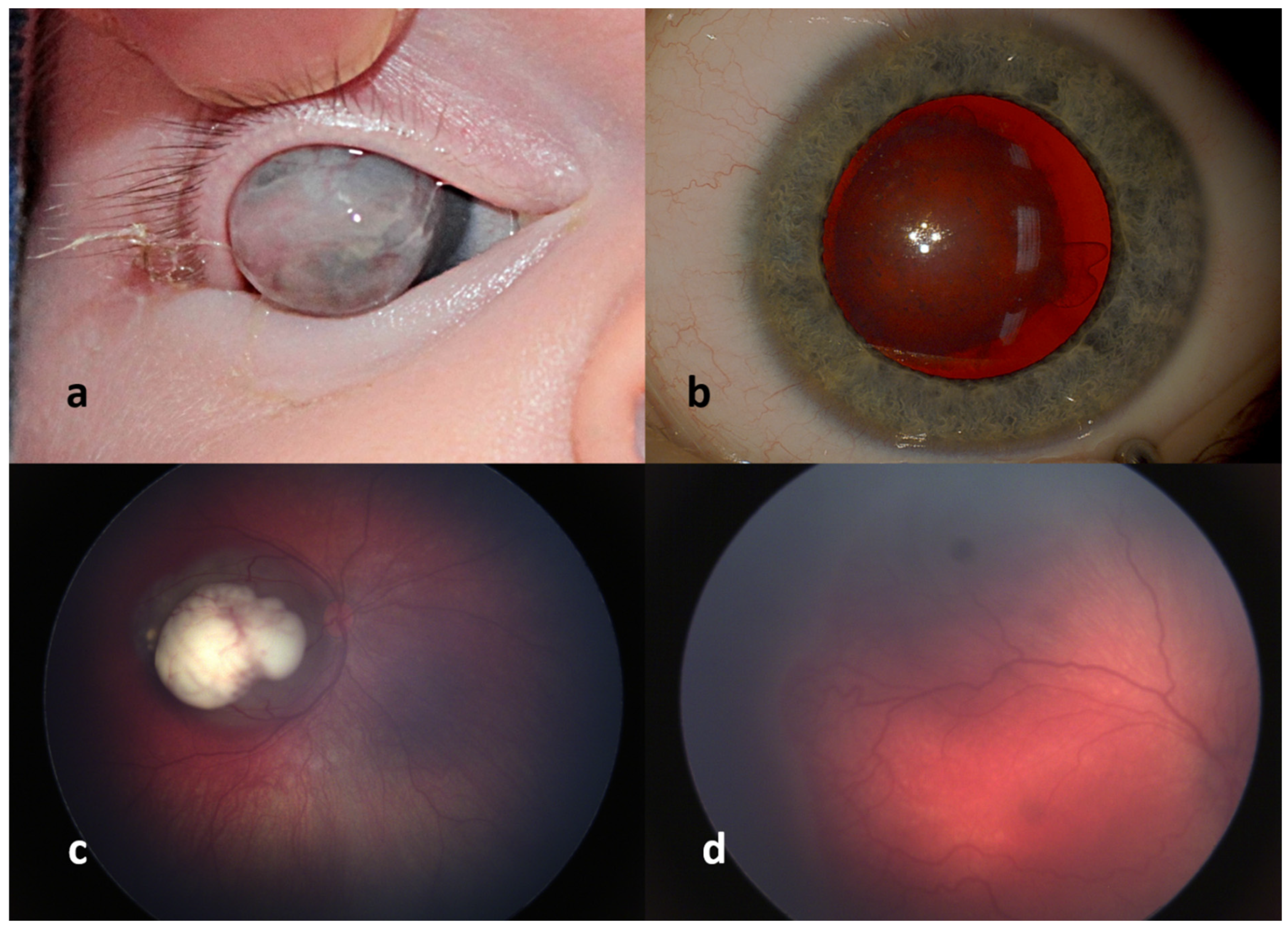 Diagnostics 12 01251 g001 550