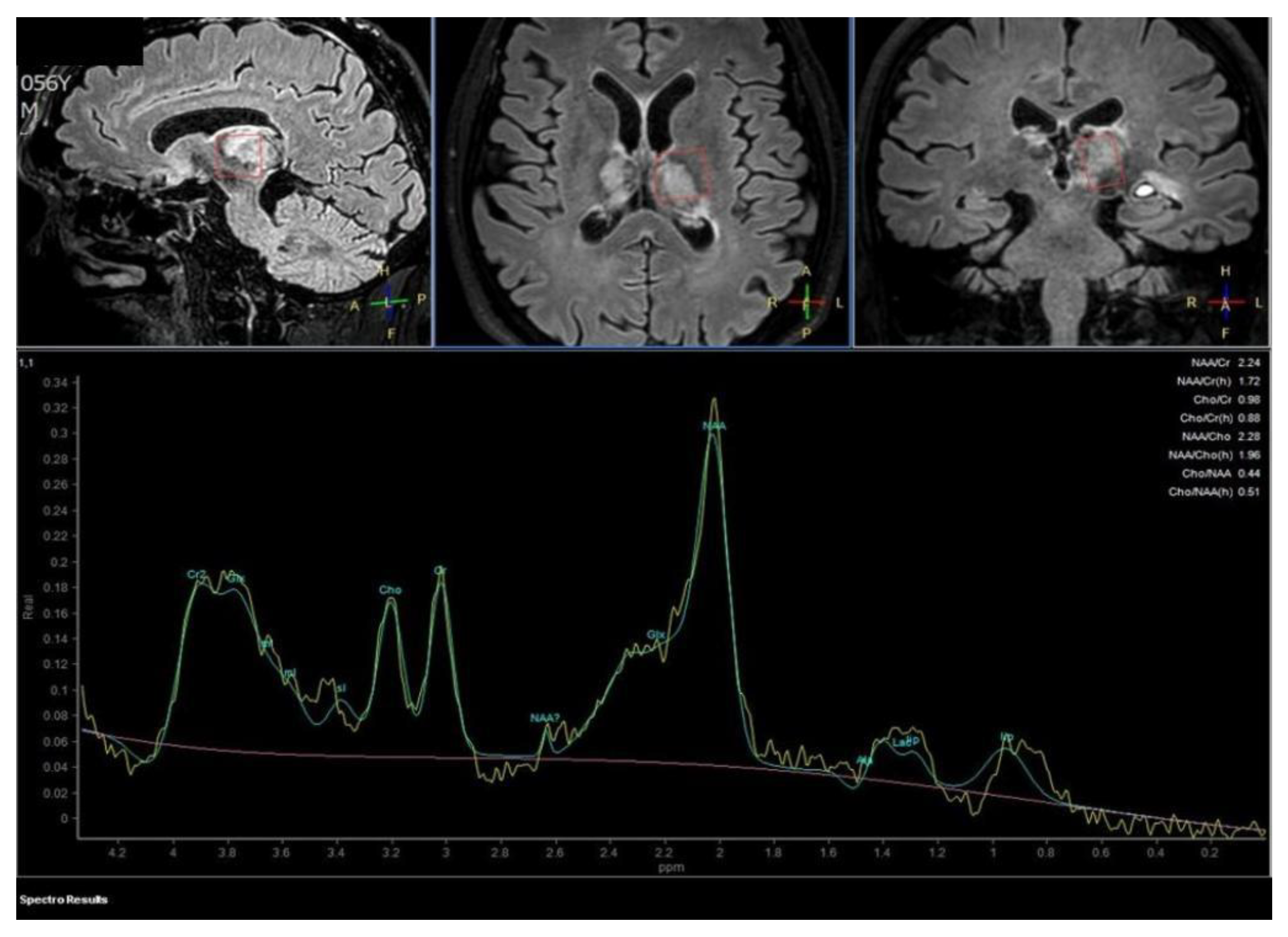 Diagnostics 12 01253 g003 550