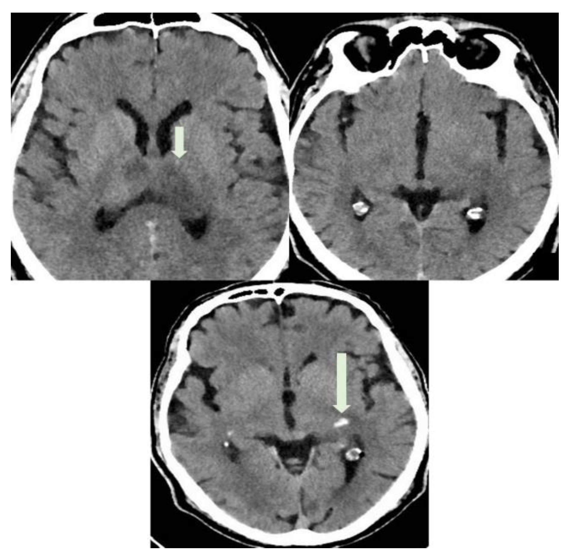 Diagnostics 12 01253 g004 550